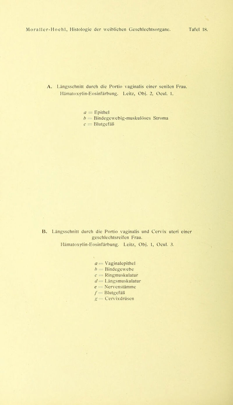 A. Längsschnitt durch die Portio vaginalis einer senilen Frau. Hämatoxylin-Eosinfärbung. Leitz, Obj. 2, Ocul. 1. a = Epithel b = Bindegewebig-muskulöses Stroma c = Blutgefäß B. Längsschnitt durch die Portio vaginalis und Cervix Uteri einer geschlechtsreifen Frau. Hämatoxplin-Eosinfärbung. Leitz, Obj. 1, Ocul. 3. o= Vaginalepithel b — Bindegewebe c = Ringmuskulatur d = Längsmuskulatur e — Nervenstämme /'— Blutgefäß g= Cervixdrüsen