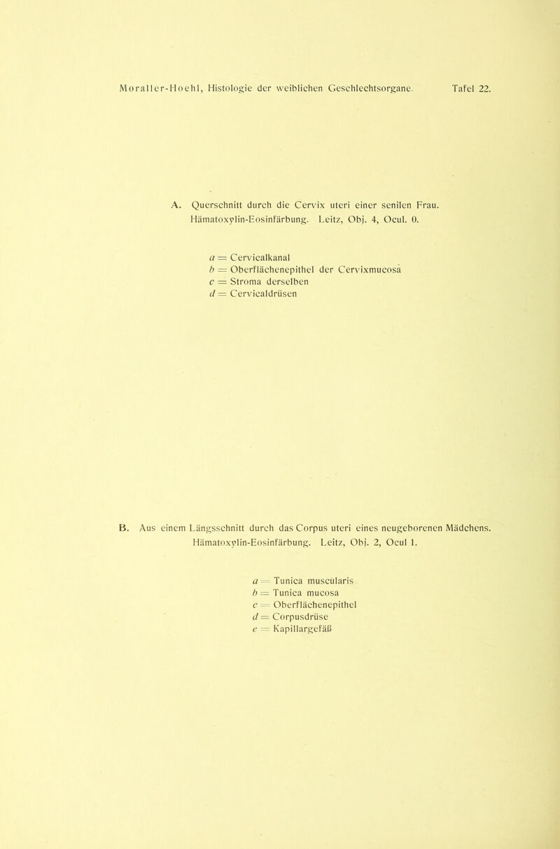 A. Querschnitt durch die Cervix uteri einer senilen Frau. Hämatoxylin-Eosinfärbung. Leitz, Obj. 4, Ocul. 0. a = Cervicalkanal b = Oberflächenepithel der Cervixniucosa c — Stroma derselben d = Cervicaldrüsen B. Aus einem Längsschnitt durch das Corpus uteri eines neugeborenen Mädchens. Hämatoxylin-Eosinfärbung. Leitz, Obj. 2, Ocul 1. a Tunica muscularis h = Tunica mucosa c = Oberflächenepithel d— Corpusdrüse e — Kapillargefäß