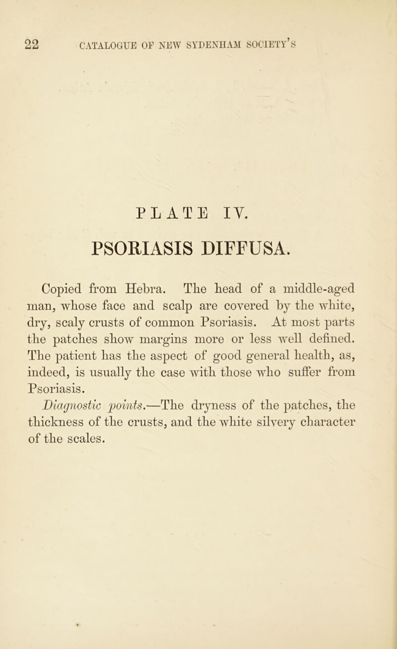 PLATE lY. PSORIASIS DIFFUSA. Copied from Hebra. Tlie head of a middle-aged man, whose face and scalp are covered by the white, dry, scaly crusts of common Psoriasis. At most parts the patches show margins more or less well defined. The patient has the aspect of good general health, as, indeed, is usually the case with those who suffer from Psoriasis. Diagnostic points.—The dryness of the patches, the thickness of the crusts, and the white silvery character of the scales.