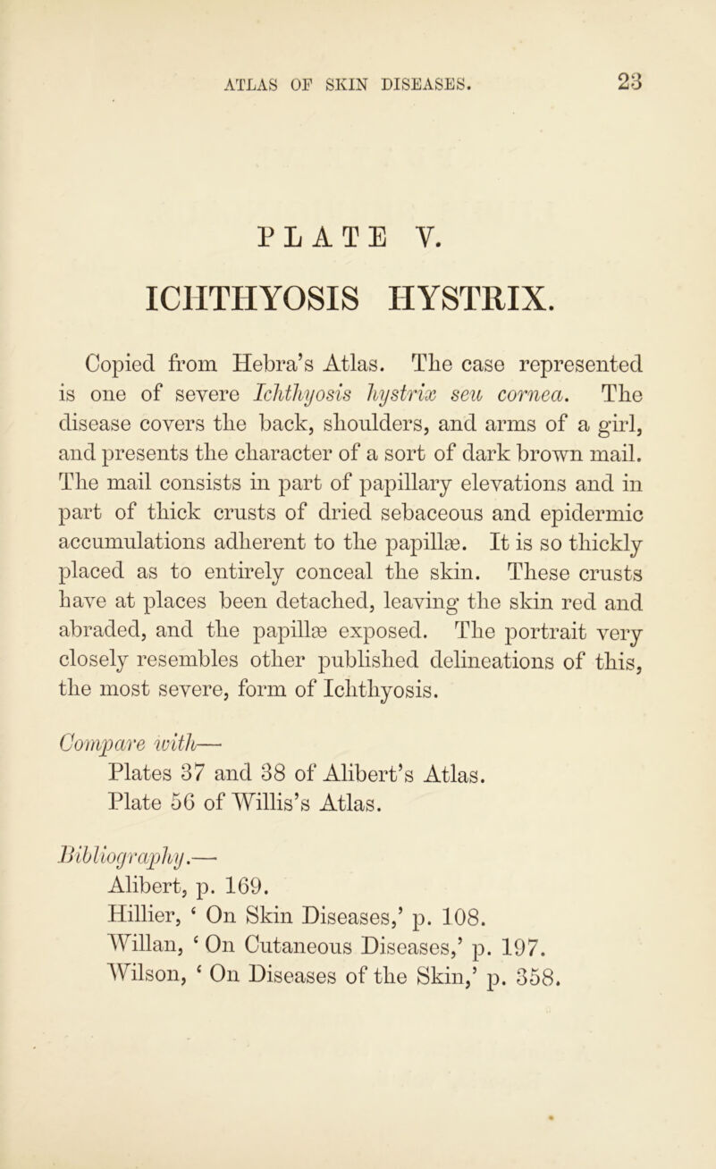 PLATE V. ICHTHYOSIS HYSTRIX. Copied from Hebra’s Atlas. Tlie case represented is one of severe Ichthyosis hijstrix seu cornea. Tlie disease covers tlie back, slioulders, and arms of a girl, and presents tlie character of a sort of dark brown mail. The mail consists in part of papillary elevations and in part of thick crusts of dried sebaceous and epidermic accumulations adherent to the papillae. It is so thickly placed as to entirely conceal the skin. These crusts have at places been detached, leaving the skin red and abraded, and the papillse exposed. The portrait very closely resembles other published delineations of this, the most severe, form of Ichthyosis. Comy^are with— Plates 37 and 38 of Alibert’s Atlas. Plate 56 of Willis’s Atlas. Bihliofjraphy.— Alibert, p. 169. Hillier, ‘ On Skin Diseases,’ p. 108. Willan, ‘ On Cutaneous Diseases,’ p. 197. Wilson, ‘ On Diseases of the Skin,’ p. 358.