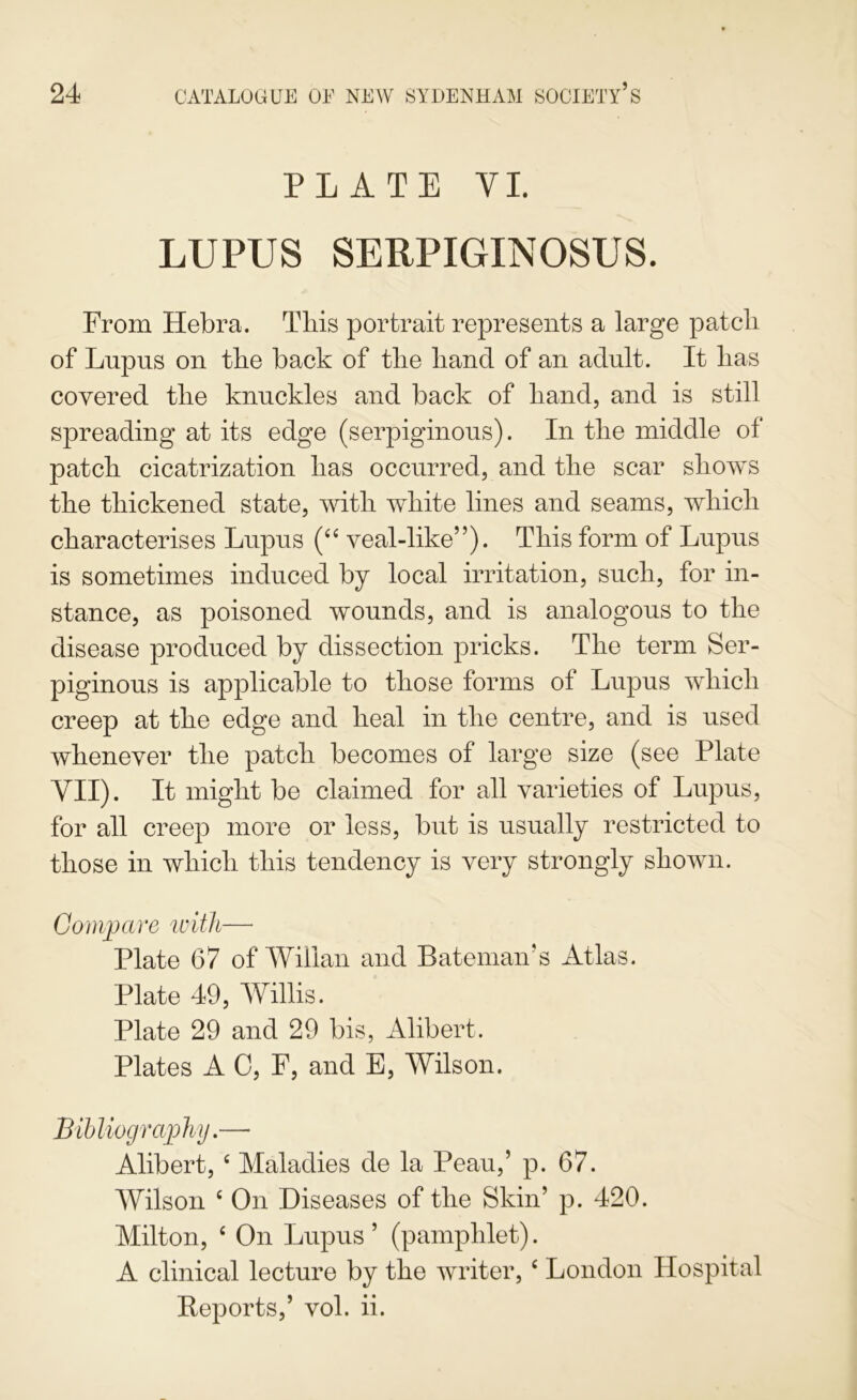 PLATE VI. LUPUS SERPIGINOSUS. From Hebra. This portrait represents a large patch of Lupus on the back of the hand of an adult. It has covered the knnckles and back of hand, and is still spreading at its edge (serpiginous). In the middle of patch cicatrization has occurred, and the scar shows the thickened state, with white lines and seams, which characterises Lupus veal-like”). This form of Lupus is sometimes induced by local irritation, such, for in- stance, as poisoned wounds, and is analogous to the disease produced by dissection pricks. The term Ser- piginous is applicable to those forms of Lupus which creep at the edge and heal in the centre, and is used whenever the patch becomes of large size (see Plate VII). It might be claimed for all varieties of Lupus, for all creep more or less, but is usually restricted to those in which this tendency is very strongly shown. Compare ivith—■ Plate 67 of Willan and Bateman's Atlas. Plate 49, Willis. Plate 29 and 29 bis, Alibert. Plates A 0, F, and B, Wilson. Bih liography.— Alibert, ^ Maladies de la Peau,’ p. 67. Wilson ^ On Diseases of the Skin’ p. 420. Milton, ‘ On Lupus ’ (pamphlet). A clinical lecture by the writer, ^ London Hospital Reports,’ vol. ii.