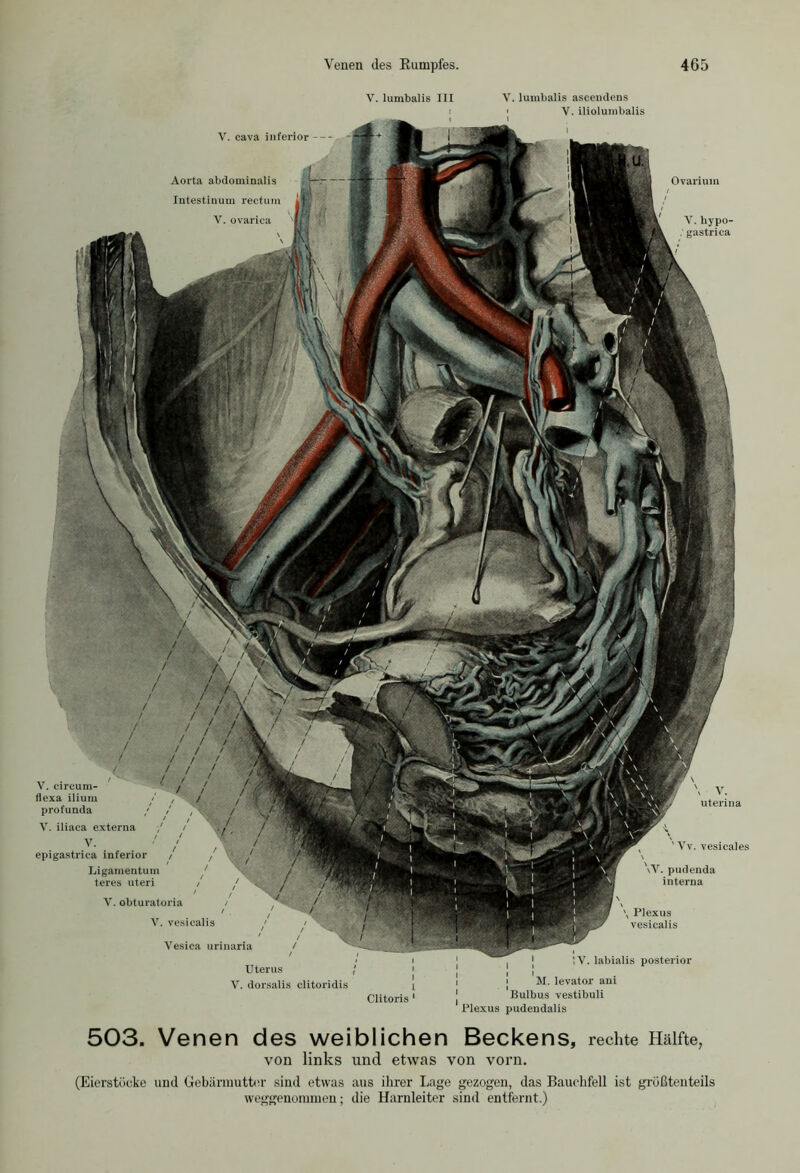 V. lumbalis III V. lumbalis ascendens f ' Y. iliolumbalis Aorta abdominalis Intestinum rectum V. ovarica V. circum- flexa ilium / profunda / V. iliaca externa ■; Y. epigastrica inferior Ligamentum teres uteri V. obturat.oria / V. vesicalis Vesica urinaria Uterus Y. dorsalis clitoridis Clitoris 1 \ V. uterina ' Yv. vesicales \V. pudenda interna \ Plexus vesicalis 1Y. labialis posterior i i i M. levator am Bulbus vestibuli Plexus pudendalis Ovarium Y.hypo- gastrica V. cava inferior -- 503. Venen des weiblichen Beckens, rechte Hälfte, von links und etwas von vorn. (Eierstücke und Gebärmutter sind etwas aus ihrer Lage gezogen, das Bauchfell ist größtenteils weggenommen; die Harnleiter sind entfernt.)