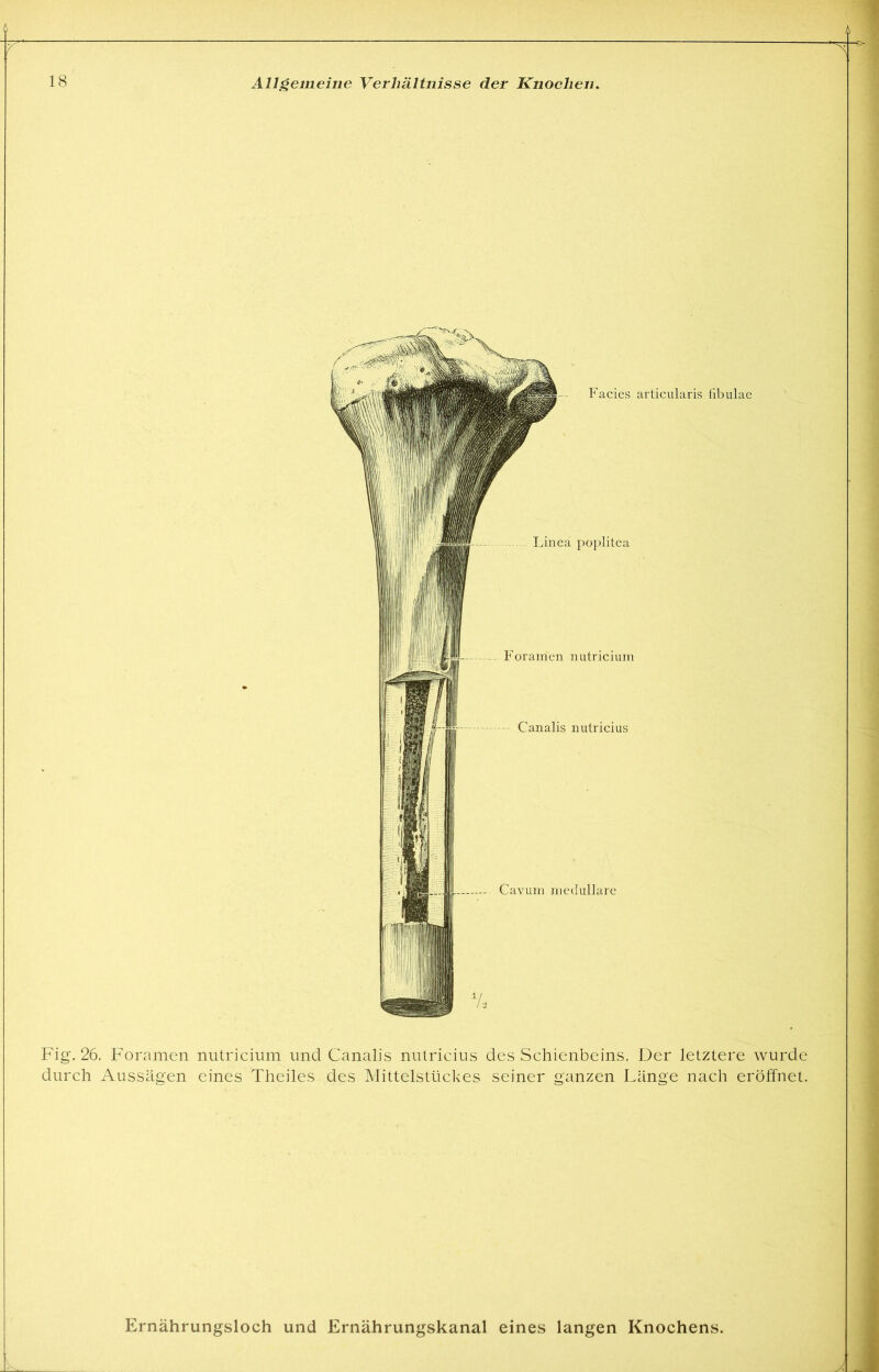 Facies articularis fibulae Linea })oi)litea Foranien iiutricium Canalis nutricius Cavuin medulläre Fig. 26. Foramen nutricium und Canalis nutricius des Schienbeins. Der letztere wurde durch Aussagen eines Theiles des Mittelstückes seiner ganzen Länge nach eröffnet. Ernährungsloch und Ernährungskanal eines langen Knochens.