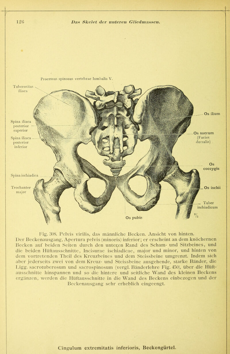 o Processus spinosiis vertebrae lumbalis V. Tuberositas iliaca Spina iliaca posterior — Superior Spina iliaca — posterior inferior Os ilium Os sacrum (Facies dorsalis) . inajor Os ischii Tuber ischiadicum Fig. 308. Pelvis virilis, das männliche Becken. Ansicht von hinten. Der Beckenausgang, Apertura pelvis (minoris) inferior; er erscheint an dem knöchernen Becken auf beiden Seiten durch den unteren Rand des Scham- und Sitzbeines, und die beiden Hüftausschnitte, Incisurae ischiadicae, major und minor, und hinten von dem vortretenden Theil des Kreuzbeines und dem Steissbeine umgrenzt. Indem sich aber jederseits zwei von dem Kreuz- und Steissbeine ausgehende, starke Bänder, die Ligg. sacrotuberosum und sacrospinosum (vergl. Bänderlehre Fig. 450), über die Hüft- ausschnitte hinspannen und so die hintere und seitliche Wand des kleinen Beckens ergänzen, werden die Hüftausschnitte in die Wand des Beckens einbezogen und der Beckenausgang sehr erheblich eingeengt.