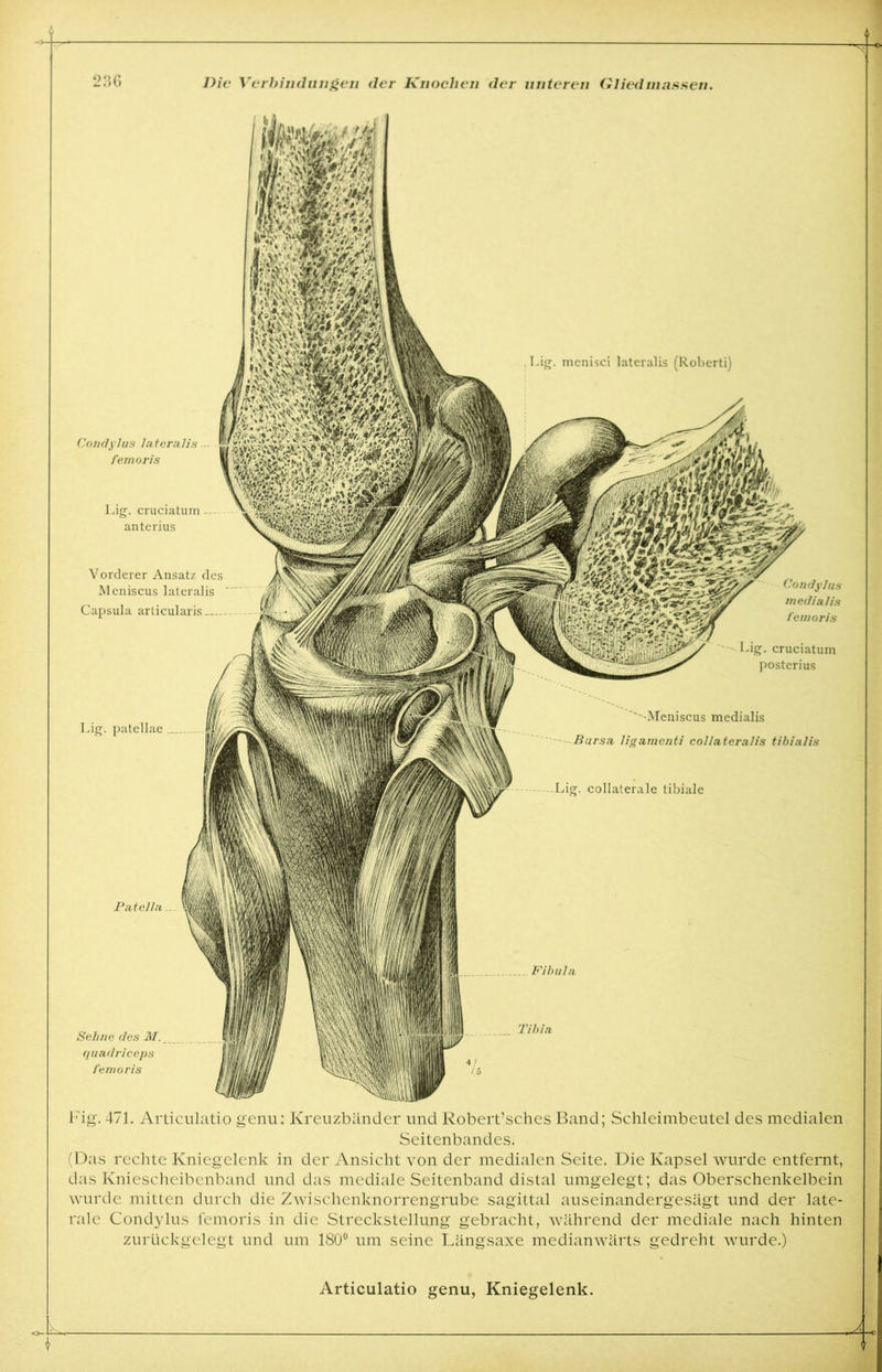 Lig. mcnisci lateralis (Roberti) Condylus lateralis — femoris Lig. cruciatum — anterius ''Meniscus medialis Bursa ligamcnti collateralis tibialis Lig. collaterale tibiale Patella Fibula Sehne des M. quadriceps femoris Tibia Vorderer Ansatz des Meniscus lateralis Capsula arlicularis Condylus medialis femoris Lig. cruciatum posterius Lig. patellae Fig. 471. Articulatio genu: Kreuzbänder und Robert’sches Band; Schleimbeutel des medialen Seitenbandes. (Das rechte Kniegelenk in der Ansicht von der medialen Seite. Die Kapsel wurde entfernt, das Kniescheibenband und das mediale Seitenband distal umgelegt; das Oberschenkelbein wurde mitten durch die Zwischenknorrengrube sagittal auseinandergesägt und der late- rale Condylus femoris in die Streckstellung gebracht, während der mediale nach hinten zurückgelegt und um 180° um seine Längsaxe medianwärts gedreht wurde.)