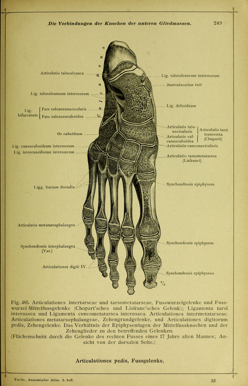 - Synchondrosis epiphyseos Articulatio talocalcanca ^ _ Lig. talocalcaneum interosseum - j j | Pars calcaneonavicularis $ bifurcatum j pars calcaneocuboidea — Os cuhoicleum Lig. cuneocuboideum interosseum Lig. intercuneiforme interosseum Lig. talocalcaneum interosseum Sustentaculum tali — Lig. dcltoideum Articulatio talo navicularis Articulatio cal- caneocuboidea . Articulatio tarsi transversa (Choparti) -Articulatio cuneonavicularis Articulatio tarsometatarsea (Lisfranci) Ligg. basium dorsalia Articulatio metatarsophalangea Synchondrosis interphalangea (Var.) Articulationes digiti IV. -^Synchondrosis epiphyseos -....Synchondrosis epiphyseos 74 Fig. 485. Articulationes intertarseae und tarsometatarseae, Fusswurzelgelenke und Fuss- wurzel-Mittelfussgelenke (Chopart’sches und Lisfranc’sches Gelenk); Ligamenta tarsi interossea und Ligamenta cuneometatarsea interossea. Articulationes intermetatarseae. Articulationes metatarsophalangeae, Zehengrundgelenke, und Articulationes digitorum pedis, Zehengelenke. Das Verhältnis der Epiphysenfugen der Mittelfussknochen und der Zehenglieder zu den betreffenden Gelenken. (Flächenschnitt durch die Gelenke des rechten Fusses eines 17 Jahre alten Mannes; An- sicht von der dorsalen Seite.) Articulationes pedis, Fussgelenke, Toldt, Anatomischer Atlas. 2. Aufl. 32