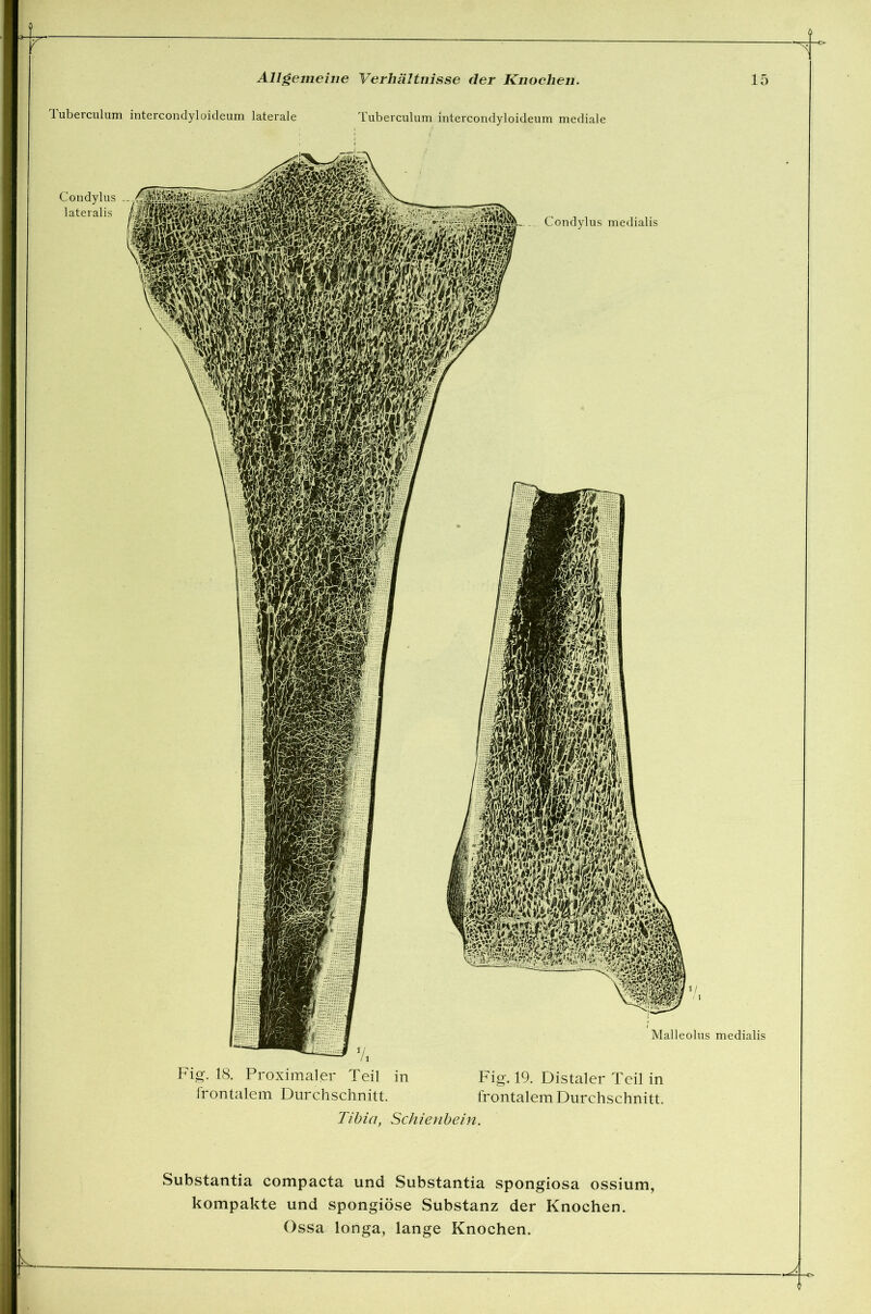 Tuberculum Condylus _ lateralis intercondyloideum laterale Tuberculum intercondyloideum mediale Fig. 18. Proximaler Teil in Fig. 19. Distaler Teil in frontalem Durchschnitt. frontalem Durchschnitt. Tibia, Schienbein. Substantia compacta und Substantia Spongiosa ossium, kompakte und spongiöse Substanz der Knochen.