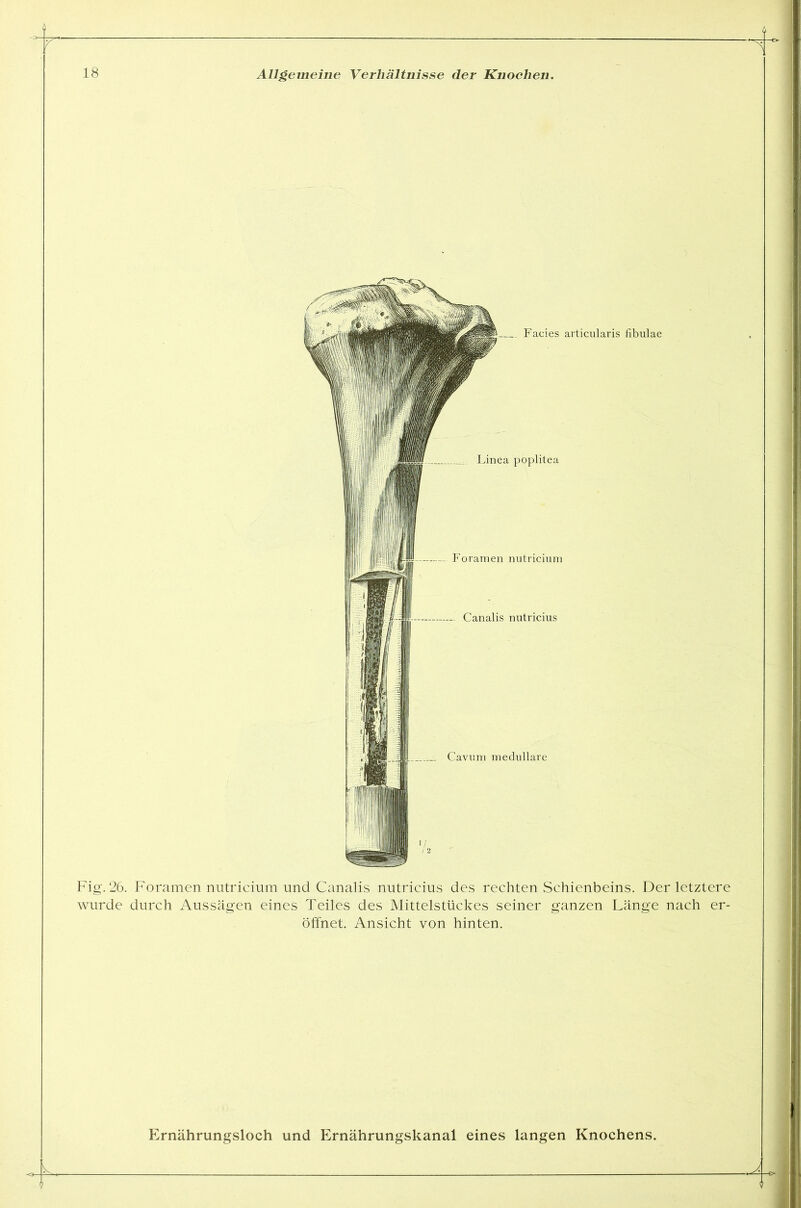 Fig. 26. Foramen nutricium und Canalis nutricius des rechten Schienbeins. Der letztere wurde durch Aussagen eines Teiles des Mittelstückes seiner ganzen Länge nach er- öffnet. Ansicht von hinten. Ernährungsloch und Ernährungskanal eines langen Knochens.