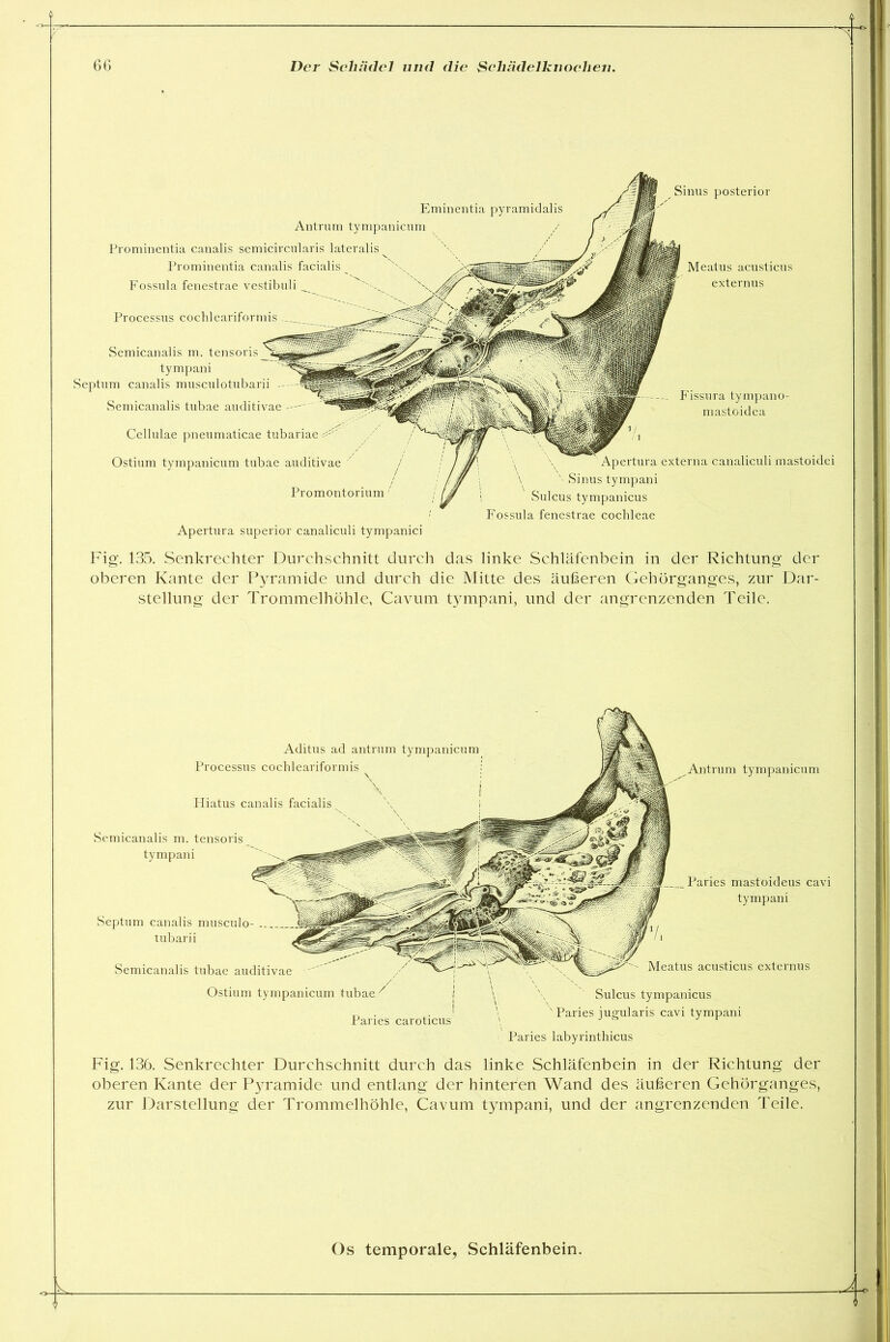 Processus cochleariformis Eminentia pyramidalis Antrum tympanicum Prominentia canalis semicircularis lateralis Prominentia canalis facialis Fossula fenestrae vestibuli Semicanalis m. tensoris tympani Septum canalis musculotubarii - Semicanalis tubae auditivae -- Cellulae pneumaticae tubariae Ostium tympanicum tubae auditivae ' / Promontorium Sinus posterior Meatus acusticus externus — Fissura tympano- mastoidea Apertura externa canaliculi mastoidei \ x- Sinus tympani Sulcus tympanicus Fossula fenestrae cochleae Apertura superior canaliculi tympanici Fig. 135. Senkrechter Durchschnitt durch das linke Schläfenbein in der Richtung der oberen Kante der Pyramide und durch die Mitte des äußeren Gehörganges, zur Dar- stellung der Trommelhöhle, Cavum tympani, und der angrenzenden Teile. Aditus ad antrum tympanicum Processus cochleariformis Hiatus canalis facialis Semicanalis m. tensoris tympani Septum canalis musculo- tubarii Semicanalis tubae auditivae Ostium tympanicum tubae Paries caroticus Antrum tympanicum Paries mastoideus cavi tympani Meatus acusticus externus Sulcus tympanicus Paries jugularis cavi tympani Paries labyrinthicus Fig. 136. Senkrechter Durchschnitt durch das linke Schläfenbein in der Richtung der oberen Kante der P}^ramide und entlang der hinteren Wand des äußeren Gehörganges, zur Darstellung der Trommelhöhle, Cavum tympani, und der angrenzenden Teile.