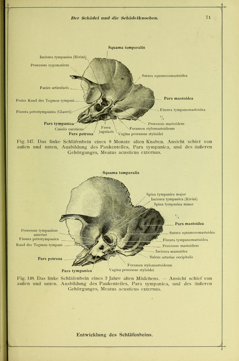 Squama temporalis Sutura squamosomastoidea Facies articularis Freier Rand des Tegmen tympani Fissura petrotympanica (Glaseri) Pars Canalis Pars petrosa' Incisura tympanica (Rivini) Processus zygomaticus ... Pars mastoidea Fissura tympanomastoid y. N. Processus mastoideus Foramen stylomastoideum ' Vagina processus styloidei ea Fig. 147. Das linke Schläfenbein eines 8 Monate alten Knaben. Ansicht schief von außen und unten. Ausbildung des Paukenteiles, Pars tympanica, und des äußeren Gehörganges, Meatus acusticus externus. Squama temporalis Spina tympanica major Incisura tympanica (Rivini) Spina tympanica minor Pars petrosa Pars tympanica Processus tympanicus anterior Fissura petrotympanica Rand des Tegmen tympani Pars mastoidea Sutura squamosomastoidea Fissura tympanomastoidea Processus mastoideus Incisura mastoidea Sulcus arteriae occipitalis Foramen stylomastoideum Vagina processus styloidei Fig. 148. Das linke Schläfenbein eines 8 Jahre alten Mädchens. — Ansicht schief von außen und unten. Ausbildung des Paukenteiles, Pars tympanica, und des äußeren Gehörganges, Meatus acusticus externus.