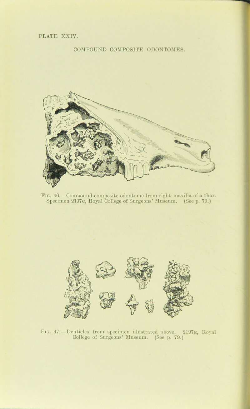 COMPOUND COMPOSITE ODONTOMES. Eig. 46.—Compound composite odontome from right maxilla of a thar. Specimen 2197c, Royal College of Surgeons’ Museum. (See p. 79.) Fig. 47.—Denticles from specimen illustrated above. 2197e, Royal College of Surgeons’ Museum. (See p. 79.)