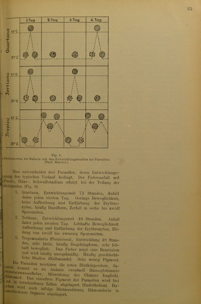 — I.Tag 2.Tag 3.Tag 4. Tag Q AI'C © © C — 0 4- $_ a 3 o 37'C. A- / . e®0 fr og* Kiß © A $ Q a 4i*c. © © c TT l\ 0 !\ A <3 0® /TM 1 \ 1 \ 4- t- h 37’C © i \ i \ i i / i / » °0 © 41'C. 3 Q 7) Q w u o 0 !_ h 37'C. 1 ^ — l ' A w \ v \ \ / / / Q ^5 \ / ■'W\ '* \ Eig. 9. Heberkurven bei Malaria mit den EntwicMungsstadien der Parasiten. (Nach Martini.) Man unterscheidet drei Parasiten, deren Entwicklungs- gang den typischen Verlauf bedingt. Der Fieberanfall mit Frost-, Flitze-, Schweißstadium erfolgt bei der Teilung der Schizonten (Fig. 9). 1. Quartana, Entwicklungszeit 72 Stunden, Anfall daher jeden vierten Tag. Geringe Beweglichkeit, keine Auftreibung und Entfärbung der Erytliro- zyten, häufig Bandform, Zerfall in sechs bis zwölf Sporozoiten. tertiana, Entwicklungszeit 48 Stunden. Anfall daher jeden zweiten Tag. Lebhafte Beweglichkeit. Auftreibung und Entfärbung der Erythrozyten, Bil- dung von zwölf bis zwanzig Sporozoiten. Tropenmalaria (Perniciosa), Entwicklung 48 Stun- den, sehr klein, häufig Siegelringform, sehr leb- lalt beweglich. Das Fieber zeigt eine Remission 'nid wird häufig unregelmäßig. Häufig geschleclit- lc. Radien (Halbmonde). Sehr wenig Pigment. Die Parasiten zerstören die roten Blutkörperchen, da- ^clnv. .U>mmt .es zu Anämie eventuell Hämo lilztumZWaSnrfleber’ Mitwirkung des Chinins mztumor. Das nd in eben L_. Hämosiderin in 3. urcli globinurie fraglich). eisenfreie Pigment der Parasiten wird frei erscluedenen Zellen abgelagert (Endothelien). Da- aueli infolge Blutzerstörunc «schiedenen Organen abgeb agert.