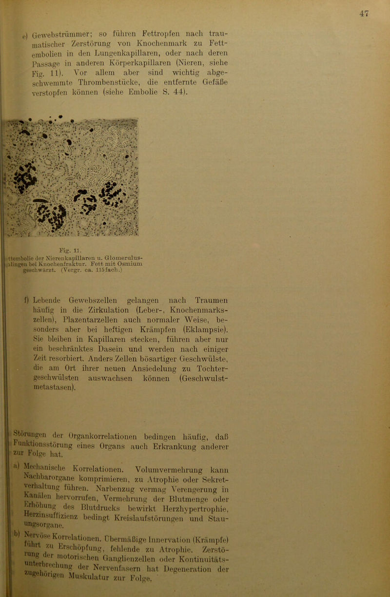 e) Gewebstrümmer; so führen Fettropfen nach trau- matischer Zerstörung von Knochenmark zu Fett- embolien in den Lungenkapillaren, oder nach deren Passage in anderen Körperkapillaren (Nieren, siehe Fig. 11). Vor allem aber sind wichtig abge- schwemmte Thrombenstücke, die entfernte Gefäße verstopfen können (siehe Embolie S. 44). Fig. 11. ttembolie der Nierenkapillaren u. Glomerulus- Uingen bei Knochenfraktur. Fett mit Osmium geschwärzt. (Yergr. ca. 115fach.) f) Lebende Getvebszellen gelangen nach Traumen häufig in die Zirkulation (Leber-, Knochenmarks- zellen), Plazentarzellen auch normaler Weise, be- sonders aber bei heftigen Krämpfen (Eklampsie). Sie bleiben in Kapillaren stecken, führen aber nur ein beschränktes Dasein und werden nach einiger Zeit resorbiert. Anders Zellen bösartiger Geschwülste, die am Ort ihrer neuen Ansiedelung zu Tochter- geschwülsten auswachsen können (Geschwulst- in etastasen). Störungen der Organkorrelationen bedingen häufig, daß unktionsstörung eines Organs auch Erkrankung anderer zur Folge hat. a) Mechanische Korrelationen. Volumvermehrung kann achbarorgane komprimieren, zu Atrophie oder Sekret- verhaltung führen. Narbenzug vermag Verengerung in analen hervorrufen, Vermehrung der Blutmenge odei Ar öjmng des Blutdrucks bewirkt Herzhypertrophie, erzinsuffizienz bedingt Kreislaufstörungen und Stau- ungsorgane. Nervöse Korrelationen. Übermäßige Innervation (Krämpfe) run iZU ^rs°höpfung, fehlende zu Atrophie. Zerstö- g 'r m dorischen Ganglienzellen oder Kontinuitäts- ziir(C lng (*er Nervenfasern hat Degeneration dei zugehörigen Muskulatur zur Fohre