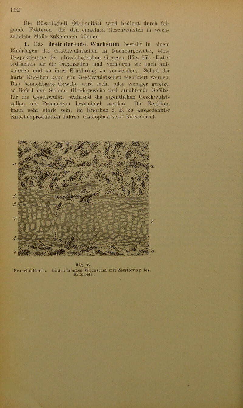 Die Bösartigkeit (Malignität) wird bedingt durch fol- gende Faktoren, die den einzelnen Geschwülsten in wech- selndem Maße zukommen können: 1. Das destruierende Wachstum besteht in einem Eindringen der Geschwulstzellen in Nachbargewebe, ohne Respektierung der physiologischen Grenzen (Fig. 37). Dabei erdrücken sie die Organzellen und vermögen sie auch auf- zulösen und zu ihrer Ernährung zu verwenden. Selbst der harte Knochen kann von Geschwulstzellen resorbiert werden. Das benachbarte Gewebe wird mehr oder weniger gereizt; es liefert das Stroma (Bindegewebe und ernährende Gefäße) für die Geschwulst, während die eigentlichen Geschwulst- zellen als Parenchym bezeichnet werden. Die Reaktion kann sehr stark sein, im Knochen z. B. zu ausgedehnter Knochenproduktion führen (osteoplastische Karzinome). Fig. 37. Bronchialkrebs. Destruierendes Wachstum mit Zerstörung des Knorpels. 0