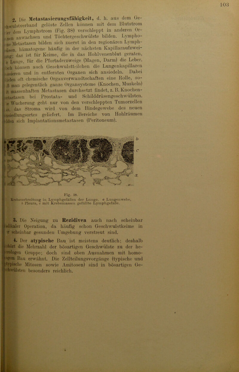 2. Die Metastasierungsfälligkeit, d. h. aus dem Ge- ; uWulstverband gelöste Zellen können mit dem Blutstrom }| ier dem Lymphstrom (Fig. 38) verschleppt in anderen Or- nen anwaclisen und Tochtergeschwülste bilden. Lympho- i ne Metastasen bilden sich zuerst in den regionären Lymph- ■ -isen hämatogene häufig in der nächsten Kapillaraufzwei- I mg; das ist für Keime, die in das Hohlvenenblut geraten, e Lunge, für die Pfortaderzweige (Magen, Darm) die Leber, ich können auch Geschwulstteilchen die Lungenkapillaren ■ ssieren und in entfernten Organen sich ansiedeln. Dabei ielen oft chemische Organverwandtschaften eine Rolle, so- I ß man gelegentlich ganze Organsysteme (Knochen, Muskeln) i it massenhaften Metastasen durchsetzt findet, z. B. Knochen- etastasen bei Prostata- und Schilddrüsengeschwülsten, j ie Wucherung geht nur von den verschleppten Tumorzellen | ts. das Stroma wird von dem Bindegewebe des neuen 1 nsiedlungsortes geliefert. Im Bereiche von Hohlräumen ; Iden sich Implantationsmetastasen (Peritoneum). Fig. 38. Krebsverbreitung in Lymphgefäßen der Lunge, a Lungenwebe, b Pleura, c mit Krebsmassen gefüllte Lymphgefäße. 3. Die Neigung zu Rezidiven auch nach scheinbar tdikaler Operation, da häufig schon Geschwulstkeime in ?r scheinbar gesunden Umgebung verstreut sind. 4, Der atypische Bau ist meistens deutlich; deshalb -hört die Mehrzahl der bösartigen Geschwülste zu der he- nologen Gruppe; doch sind oben Ausnahmen mit liomo- >gem Bau erwähnt. Die Zellteilungsvorgänge (typische und typische Mitosen sowie Amitosen) sind in bösartigen Ge- diwiilsten besonders reichlich. r