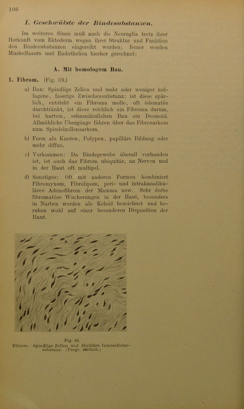 Im weiteren Sinne muß auch die Neuroglia trotz ihrer Herkunft vom Ektoderm wegen ihrer Struktur und Funktion den Bindesubstanzen eingereiht werden; ferner werden Muskelfasern und Endothelien hierher gerechnet; 1. Fibrom. (Fig. 39.) a) Bau: Spindlige Zellen und mehr oder weniger kol- lagene, faserige Zwischensubstanz; ist diese spär- lich, entsteht ein Fibroma molle, oft ödematös durchtränkt, ist diese reichlich ein Fibroma durum, bei hartem, sehnenähnlichen Bau ein Desmoid. Allmähliche Übergänge führen über das Fibrosarkom zum Spindelzellensarkom. b) Form als Knoten, Polypen, papilläre Bildung oder mehr diffus. c) Vorkommen: Da Bindegewebe überall vorhanden ist, ist auch das Fibrom ubiquitär, an Nerven und in der Haut oft multipel. d) Sonstiges: Oft mit anderen Formen kombiniert Fibromyxom, Fibrolipom, peri- und intrakanaliku- läres Adenofibrom der Mamma usw. Sehr derbe fibromatöse Wucherungen in der Haut, besonders in Narben werden als Keloid bezeichnet und be- ruhen wohl auf einer besonderen Disposition der Haut. A. Mit homologem Bau. Fig. 39. Fibrom. Spindlige Zellen und fibrilläre Interzellular- substanz. (Vergr. 480 fach.)