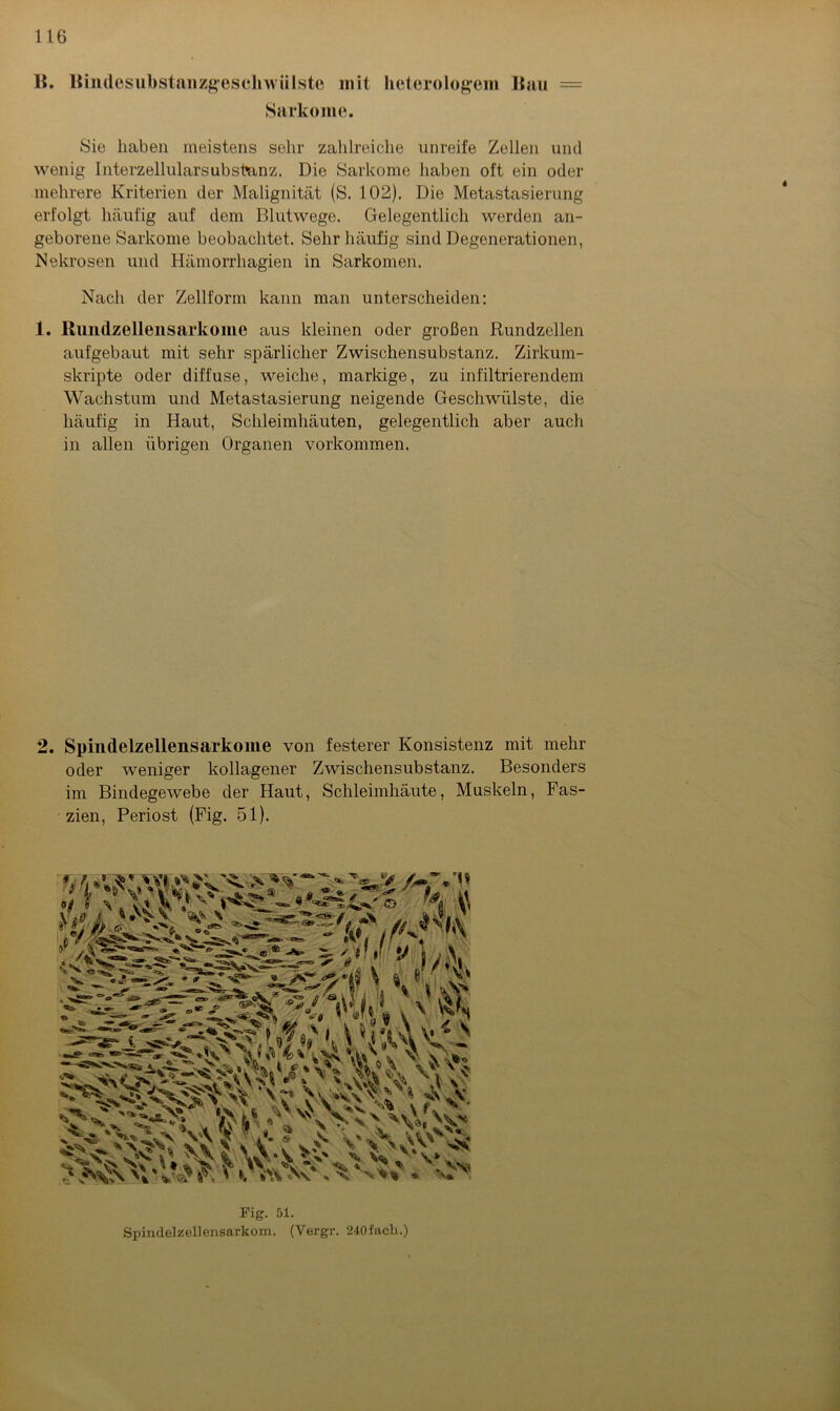 15. Bindesubstanzgesoli wülste mit heterologein Bau — Sarkome. Sie haben meistens sehr zahlreiche unreife Zellen und wenig Interzellularsubsteinz. Die Sarkome haben oft ein oder mehrere Kriterien der Malignität (S. 102). Die Metastasierung erfolgt häufig auf dem Blutwege. Gelegentlich werden an- geborene Sarkome beobachtet. Sehr häufig sind Degenerationen, Nekrosen und Hämorrhagien in Sarkomen. Nach der Zellform kann man unterscheiden: 1. Rundzellensarkome aus kleinen oder großen Rundzellen aufgebaut mit sehr spärlicher Zwischensubstanz. Zirkum- skripte oder diffuse, weiche, markige, zu infiltrierendem Wachstum und Metastasierung neigende Geschwülste, die häufig in Haut, Schleimhäuten, gelegentlich aber auch in allen übrigen Organen Vorkommen. 2. Spindelzellensarkome von festerer Konsistenz mit mehr oder weniger kollagener Zwischensubstanz. Besonders im Bindegewebe der Haut, Schleimhäute, Muskeln, Fas- zien, Periost (Fig. 51). Fig. 51. Spindelzellensarkom. (Vergr. 240facli.)