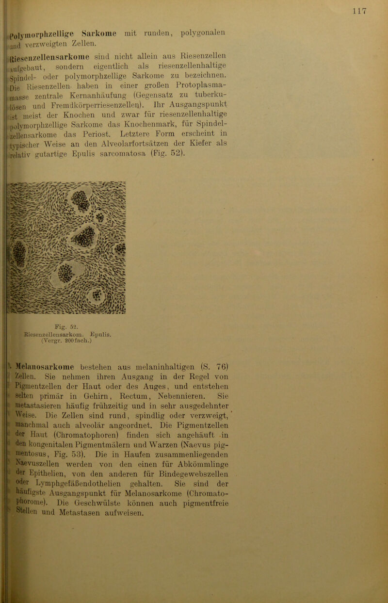 polymorphzellige Sarkome mit runden, polygonalen I all(j verzweigten Zellen. i Riesenzellensarkome sind nicht allein aus Riesenzellen laufeebaut, sondern eigentlich als riesenzellenhaltige j Spindel- oder polymorphzellige Sarkome zu bezeichnen. Die Riesenzellen haben in einer großen Protoplasma- inasse zentrale Kernanhäufung (Gegensatz zu tuberku- lösen und Fremdkörperriesenzellen). Ihr Ausgangspunkt ,st meist der Knochen und zwar für riesenzellenhaltige polymorphzellige Sarkome das Knochenmark, für Spindel- zellensarkome das Periost. Letztere Form erscheint in typischer Weise an den Alveolarfortsätzen der Kiefer als relativ gutartige Epulis sarcomatosa (Fig. 52). k’/ *(»h ^ Fig. 52. Riesenzellensarkom. Epulis. (Vergr. 200fach.) Melanosarkome bestehen aus melaninhaltigen (S. 76) Zellen. Sie nehmen ihren Ausgang in der Regel von Pigmentzellen der Haut oder des Auges, und entstehen • selten primär in Gehirn, Rectum, Nebennieren. Sie metastasieren häufig frühzeitig und in sehr ausgedehnter Weise. Die Zellen sind rund, spindlig oder verzweigt, manchmal auch alveolär angeordnet. Die Pigmentzellen der Haut (Chromatophoren) finden sich angehäuft in den kongenitalen Pigmentmälern und Warzen (Naevus pig- mentosus, Fig. 53). Die in Haufen zusammenliegenden Naevuszellen werden von den einen für Abkömmlinge der Epithelien, von den anderen für Bindegewebszellen oder Lymphgefäßendothelien gehalten. Sie sind der häufigste Ausgangspunkt für Melanosarkome (Chromato- phorome). Die Geschwülste können auch pigmentfreie Stellen und Metastasen aufweisen.