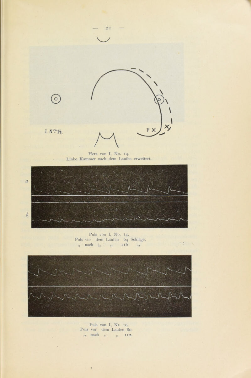 t L N1H. Herz von I, No. 14. Linke Kammer nach dem Laufen enveitert. Puls von T, No. 14. Puls vor deni Laufen 64 Sclilage, „ nach |„ • ■ „ 116 „ Puls von 1, Nr. 10. Puls vor dem Laufen 80. nach jj 112.