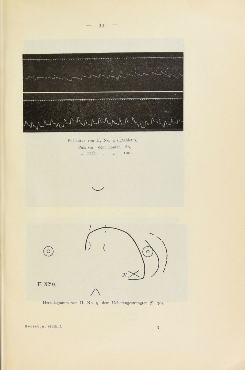 Pulskurve von II, No. 4 (,,Alhlet“). Puls vor dem Laufen 80. „ nach „ „ too. JL. 9. A Herzdiagramm von II, No. 9, dem Ueberangestrengten (S. 30). Ilenschon, Skidlauf. 3