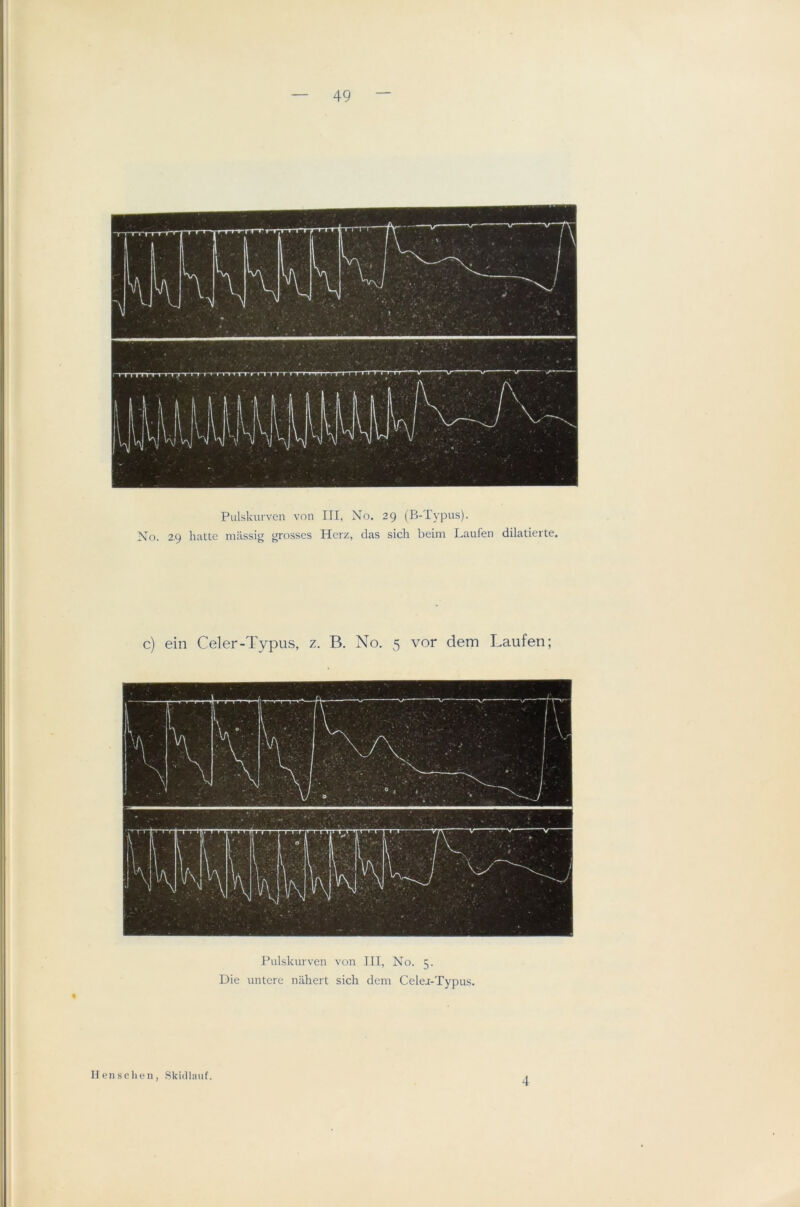Pulskurven von III, No. 29 (B-Typus). No. 2,9 hattc massig grosses Herz, das sicli beim Laufen dilatierte. c) ein Celer-Typus, z. B. No. 5 vor dem Laufen; Pulskurven von III, No. 5. Die untere nlihert sich dem Celer-Typus. Hen sc hen, Skid Ian f. 4
