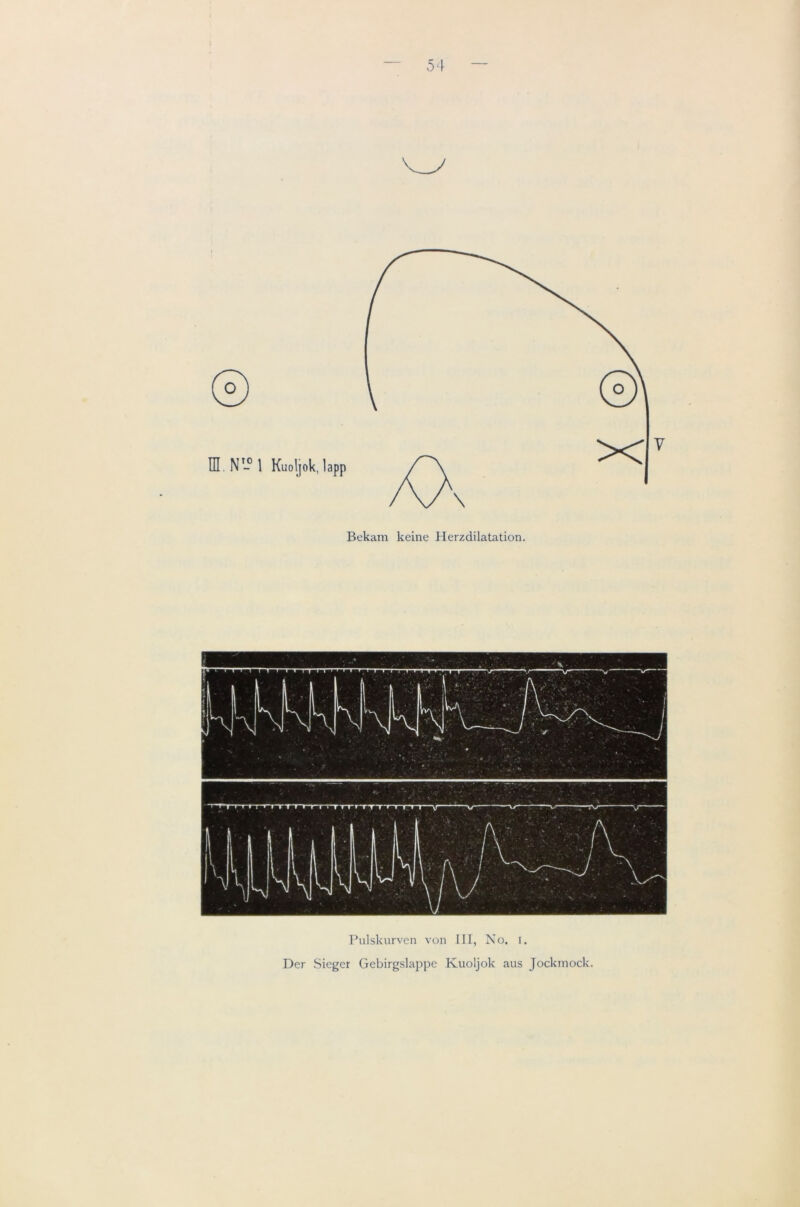 m .N'- 1 Kuoljok, lapp \ Bekam keine Herzdilatation. Pulskurven von III, No. i. Der Sieger Gebirgslappe Kuoljok aus Jockmocl