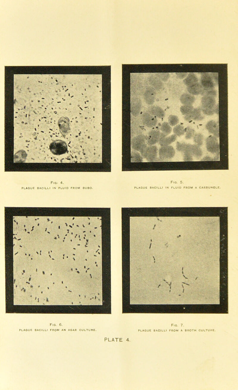 Fig- 4. PLAQUE BACILLI IN FLUID FROM BUBO. Fig. 5. PLAGUE BACILLI IN FLUID FROM A CARBUNCLE. Fig. 6. PLAGUE BACILLI FROM AN AGAR CULTURE. Fig. 7. PLAGUE BACILLI FROM A BROTH CULTURE.