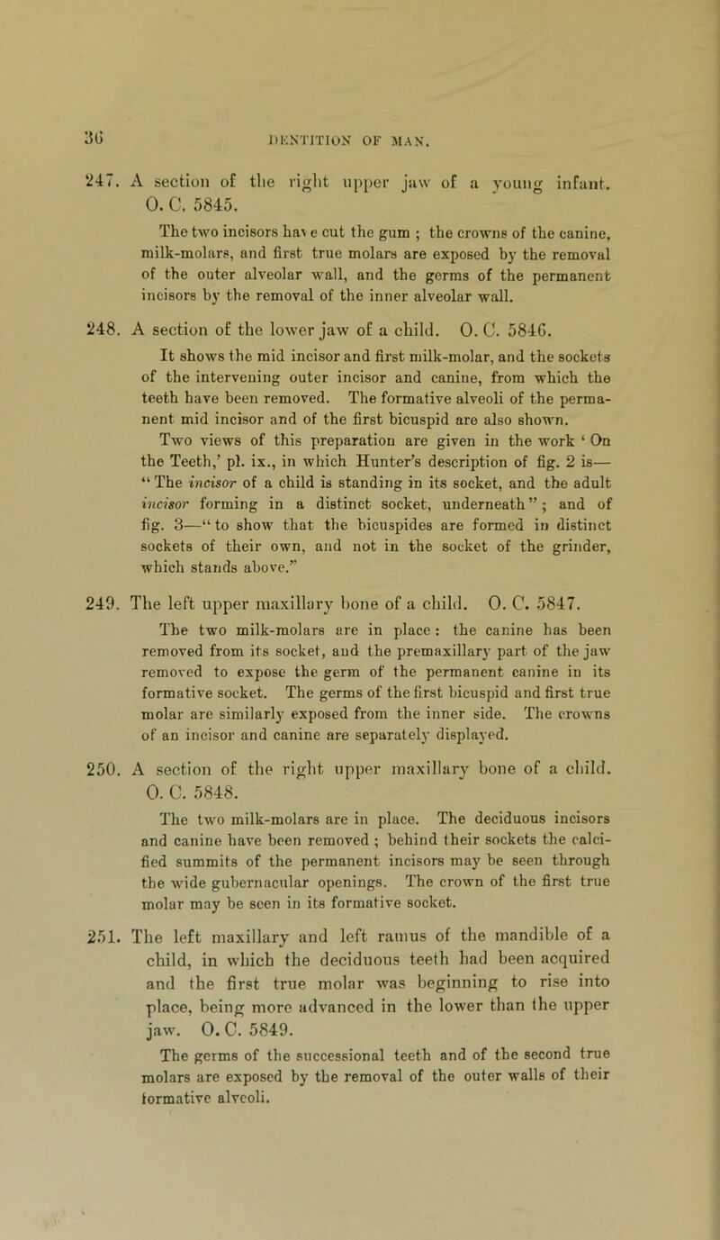 3G ‘247. A section of tlie right upper jaw of a young infant. 0. C. 5845. The two incisors hav e cut the gum ; the crowns of the canine, milk-molars, and first true molars are exposed b)’ the removal of the outer alveolar wall, and the germs of the permanent incisors by the removal of the inner alveolar wall. 248. A section of the lower jaw of a child. 0. C. 5846. It shows the mid incisor and first milk-molar, and the sockets of the intervening outer incisor and canine, from which the teeth have been removed. The formative alveoli of the perma- nent mid incisor and of the first bicuspid are also shown. Two views of this preparation are given in the work ‘ On the Teeth,’ pi. ix., in which Hunter’s description of fig. 2 is— “ The incisor of a child is standing in its socket, and the adult incisor forming in a distinct socket, underneath”; and of fig. 3—“ to show that the bicuspides are formed in distinct sockets of their own, and not in the socket of the grinder, which stands above.” 249. The left upper maxillary hone of a child. 0. C. 5847. The two milk-molars are in place : the canine has been removed from its socket, and the premaxillary part of the jaw removed to expose the germ of the permanent canine iu its formative socket. The germs of the first bicuspid and first true molar are similarly exposed from the inner side. The crowns of an incisor and canine are separately displayed. 250. A section of the right upper maxillary bone of a child. 0. C. 5848. The two milk-molars are in place. The deciduous incisors and canine have been removed ; behind (heir sockets the calci- fied summits of the permanent incisors may be seen through the wide gubernacular openings. The crown of the first true molar may be seen in its formative socket. 251. The left maxillary and left ramus of the mandible of a child, in which the deciduous teeth had been acquired and the first true molar was beginning to rise into place, being more advanced in the low'er than the upper jaw. 0. C. 5849. The germs of the successional teeth and of the second true molars are exposed by the removal of the outer walls of their formative alveoli.