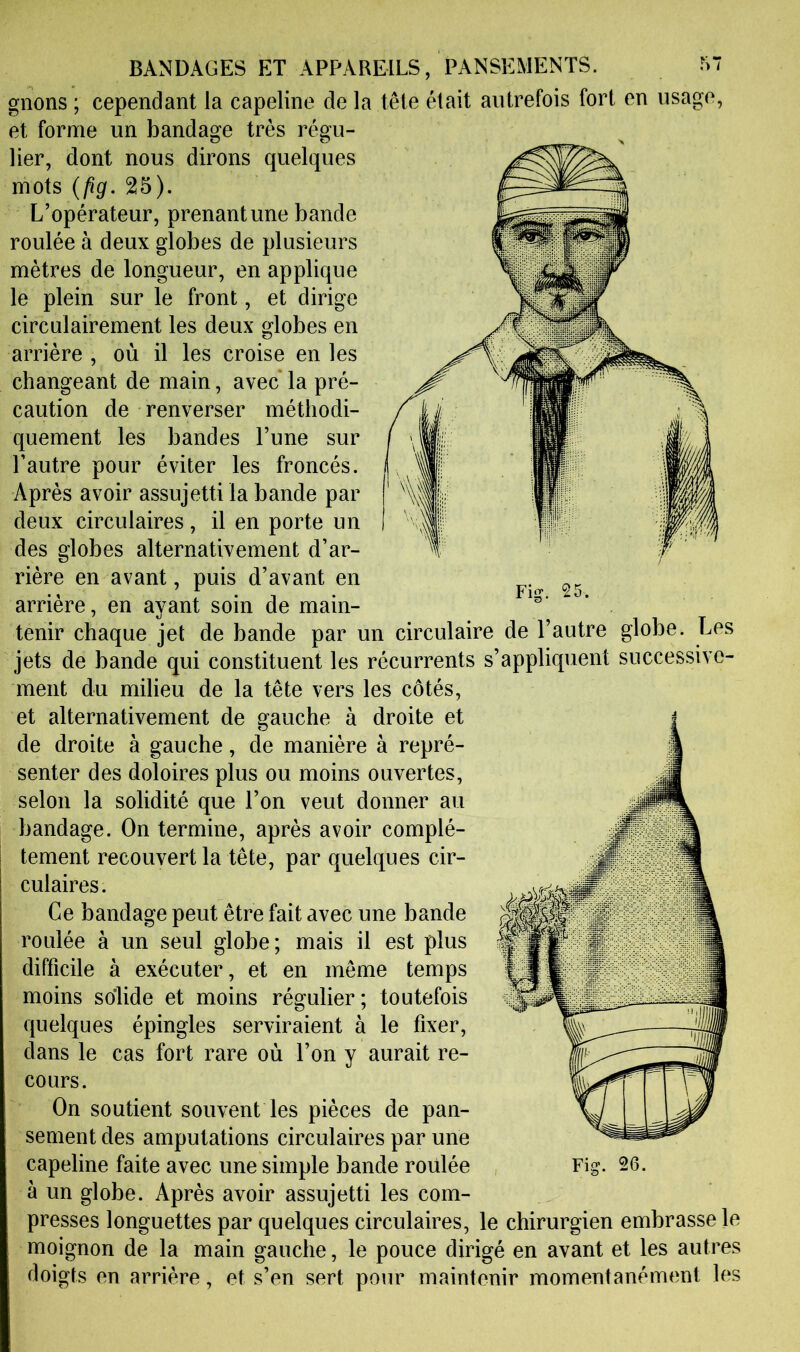 gnons ; cependant la capeline de la tête était autrefois fort en usage, lier, dont nous dirons quelques mots {fig. 25). L’opérateur, prenant une bande roulée à deux globes de plusieurs mètres de longueur, en applique le plein sur le front, et dirige circulairement les deux globes en arrière , où il les croise en les changeant de main, avec la pré- caution de renverser méthodi- quement les bandes l’une sur l’autre pour éviter les froncés. Après avoir assujetti la bande par deux circulaires, il en porte un des globes alternativement d’ar- rière en avant, puis d’avant en arrière, en ayant soin de main- tenir chaque jet de bande par un circulaire de l’autre globe. Les jets de bande qui constituent les récurrents s’appliquent successive- ment du milieu de la tête vers les côtés, et alternativement de gauche à droite et de droite à gauche, de manière à repré- senter des doloires plus ou moins ouvertes, selon la solidité que l’on veut donner au bandage. On termine, après avoir complè- tement recouvert la tête, par quelques cir- culaires. Ce bandage peut être fait avec une bande roulée à un seul globe; mais il est plus difficile à exécuter, et en même temps moins so’lide et moins régulier; toutefois quelques épingles serviraient à le fixer, dans le cas fort rare où l’on y aurait re- cours. On soutient souvent les pièces de pan- sement des amputations circulaires par une capeline faite avec une simple bande roulée à un globe. Après avoir assujetti les com- presses longuettes par quelques circulaires, le chirurgien embrasse le moignon de la main gauche, le pouce dirigé en avant et les autres doigts en arrière, et s’en sert pour maintenir momentanément les