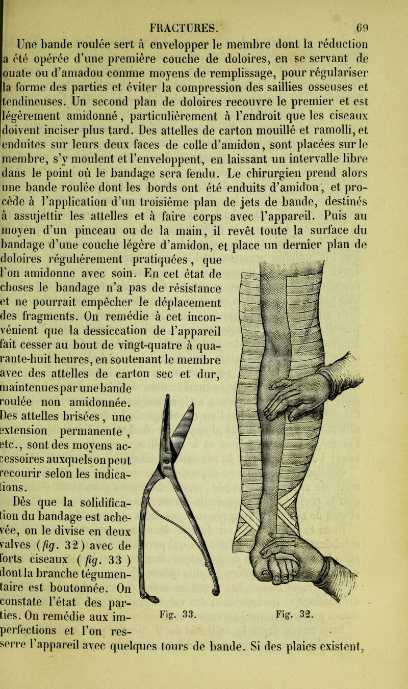Une bande roulée sert à envelopper le membre dont la réduction a été opérée d’une première couche de doloires, en se servant de ouate ou d’amadou comme moyens de remplissage, pour régulariser la forme des parties et éviter la compression des saillies osseuses et tendineuses. Un second plan de doloires recouvre le premier et est llégérement amidonné, particulièrement à l’endroit que les ciseaux [doivent inciser plus tard. Des attelles de carton mouillé et ramolli, et enduites sur leurs deux faces de colle d’amidon, sont placées sur le membre, s’y moulent et l’enveloppent, en laissant un intervalle libre dans le point où le bandage sera fendu. Le chirurgien prend alors une bande roulée dont les bords ont été enduits d’amidon , et pro- cède à l’application d’un troisième plan de jets de bande, destinés à assujettir les attelles et à faire corps avec l’appareil. Puis au moyen d’un pinceau ou de la main, il revêt toute la surface du bandage d’une couche légère d’amidon, et place un dernier plan de doloires régulièrement pratiquées, que l’on amidonne avec soin. En cet état de choses le bandage n’a pas de résistance et ne pourrait empêcher le déplacement des fragments. On remédie à cet incon- vénient que la dessiccation de l’appareil fait cesser au bout de vingt-quatre à qua- rante-huit heures, en soutenant le membre avec des attelles de carton sec et dur, maintenues par une bande roulée non amidonnée. Des attelles brisées, une extension permanente , etc., sont des moyens ac- cessoires auxquels on peut recourir selon les indica- tions. Dès que la solidifica- tion du bandage est ache- vée, on le divise en deux valves {fig. 32) avec de forts ciseaux {fig. 33 ) dont la branche tégumen- taire est boutonnée. On constate l’état des par- perfections et l’on res- serre l’appareil avec quelcpies tours de bande. Si des plaies existent,