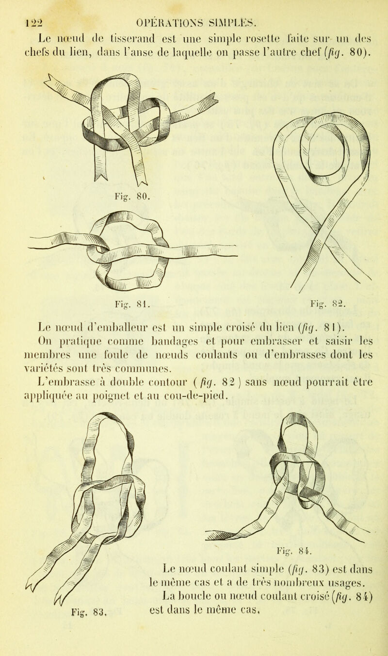 Le nœud de tisserand est une simple rosette laite sur un d(‘s chefs dn lien, dans Panse de laquelle on passe Pautre chef 80). Fig. 81. Fig. 8^. Le namd (Pemhallenr est un simple croisé dn lien (fig. 81). On pratique comme bandages et pour embrasser et saisir les memhi’es une foule de mends coulants on d’embrasses dont les variétés sont très connnnnes. L’embrasse à double contour {fig. 82 ) sans nœud pourrait être appliquée au poignet et au cou-de-pied. Fig. 83,