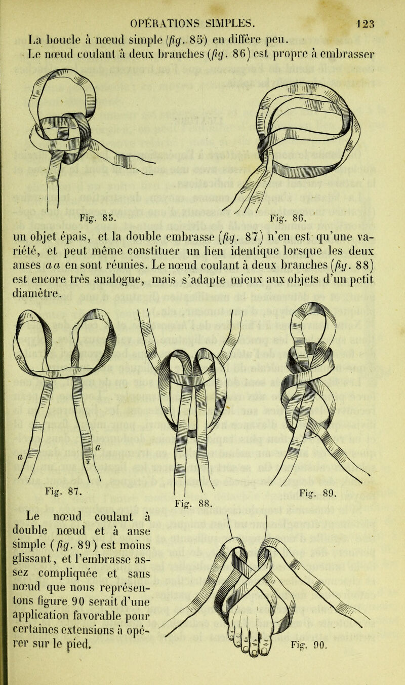 La boucle à nœud simple (/igf. 85) en diffère peu. Le nœud coulant à deux branches {fig. 86) est propre à embrasser un objet épais, et la double embrasse [fig. 87) n’en est qu’une va- riété, et peut même constituer un lien identique lorsque les deux anses a a en sont réunies. Le nœud coulant à deux branches [fig. 88) est encore très analogue, mais s’adapte mieux aux objets d’un petit diamètre. Fig. 87. Le nœud coulant à double nœud et à anse simple 89) est moins glissant, et l’embrasse as- sez compliquée et sans nœud que nous représen- tons figure 90 serait d’une application favorable pour certaines extensions à opé- rer sur le pied. Fig. 88. Fig, 90.