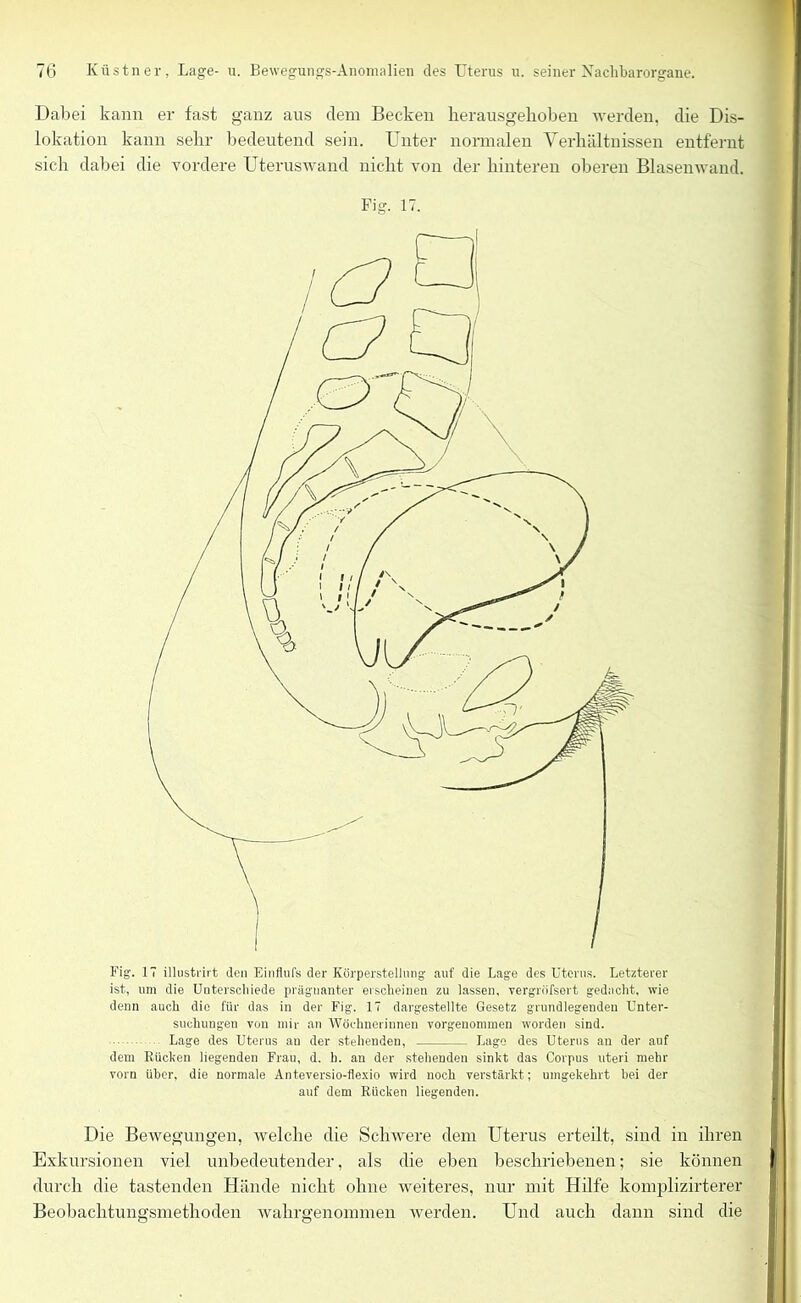 Dabei kann er fast ganz aus dem Becken lierausgelioben werden, die Dis- lokation kann sehr bedeutend sein. Unter normalen Verhältnissen entfernt sich dabei die vordere Uteruswand nicht von der hinteren oberen Blasenwand. Fig. 17. Fig. 17 illustrirt (len Einflufs der Körperstellung auf die Lage des Uterus. Letzterer ist, um die Unterschiede prägnanter erscheinen zu lassen, vergröfscrt gedacht, wie denn auch die für das in der Fig. 17 dargestellte Gesetz grundlegenden Unter- suchungen von mir an Wöchnerinnen vorgeuommen worden sind. Lage des Uterus an der stehenden, Lage des Uterus an der auf dem Rücken liegenden Frau, d. b. an der stehenden sinkt das Corpus uteri mehr vorn über, die normale Anteversio-flexio wird noch verstärkt; umgekehrt bei der auf dem Rücken liegenden. Die Bewegungen, welche die Schwere dem Uterus erteilt, sind in ihren Exkursionen viel unbedeutender, als die eben beschriebenen; sie können durch die tastenden Hände nicht ohne weiteres, nur mit Hilfe komplizirterer Beobachtunsrsmethoden waliruenominen werden. Und auch dann sind die