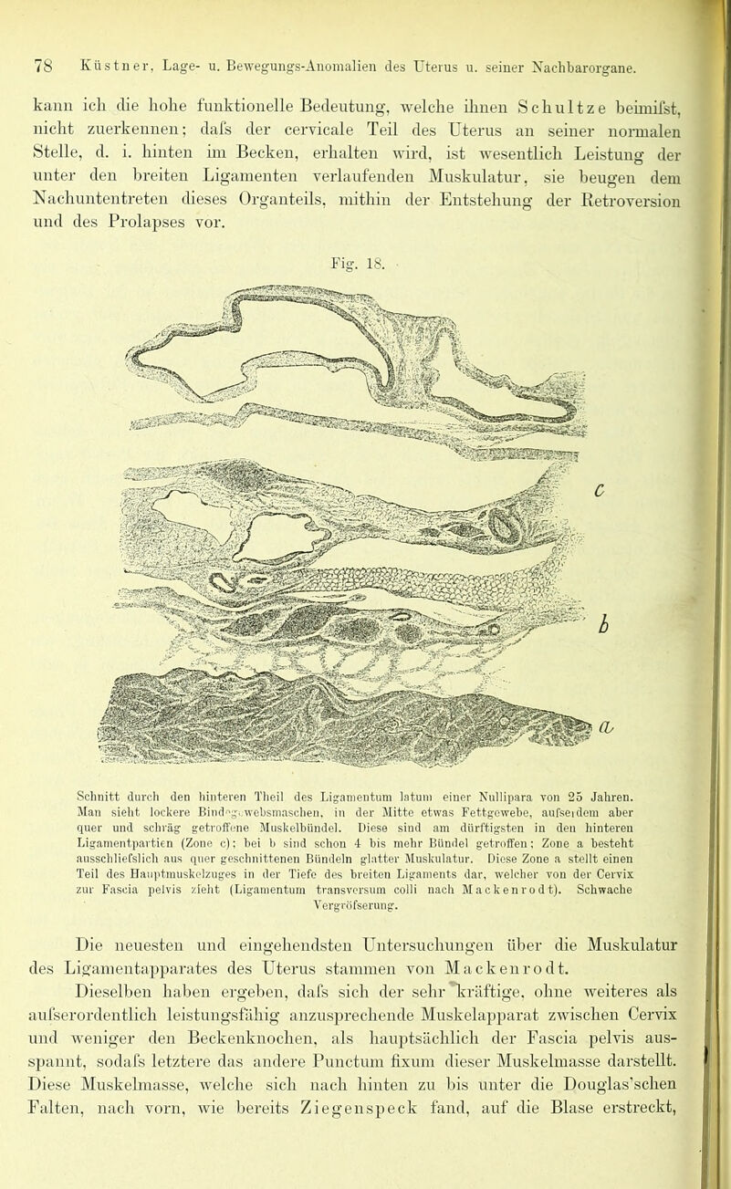 kann ick die koke funktionelle Bedeutung, welche ilinen Sckultze beimifst, nickt zuerkennen; dafs der cervicale Teil des Uterus an seiner normalen Stelle, d. i. kinten im Becken, erkalten wird, ist wesentlich Leistung der unter den breiten Ligamenten verlaufenden Muskulatur, sie beugen dem Nackuntentreten dieses Organteils, mitliin der Entstellung der Retroversion und des Prolapses vor. Fig. 18. Schnitt durch den hinteren Theil des Ligamentum latuni einer Nuliipara von 25 Jahren. Man sieht lockere Bindgvwebsmaschen, in der Mitte etwas Fettgewebe, aufserdem aber quer und schräg getroffene Muskelbündel. Diese sind am dürftigsten in den hinteren Ligamentpartien (Zone c); bei b sind schon 4 bis mehr Bündel getroffen; Zone a besteht ausschließlich aus quer geschnittenen Bündeln glatter Muskulatur. Diese Zone a stellt einen Teil des Hauptmuskelzuges in der Tiefe des breiten Ligaments dar, welcher von der Cervix zur Fascia pelvis zieht (Ligamentum transvorsum colli nach Mackenrodt). Schwache Vergröfserung. Die neuesten und eingekendsten Untersuckungen über die Muskulatur des Ligamentapparates des Uterus stammen von Mackenrodt. Dieselben kaben ergeben, dafs sieb der sekr kräftige, okne weiteres als aufserordentlich leistungsfähig anzuspreckende Muskelapparat zwischen Cervix und weniger den Beckenknocken, als hauptsächlich der Fascia pelvis aus- spannt, sodafs letztere das andere Punctum fixum dieser Muskelmasse darstellt. Diese Muskelmasse, welcke sich nach kinten zu bis unter die Douglas’schen Falten, nach vorn, wie bereits Ziegenspeck fand, auf die Blase erstreckt,