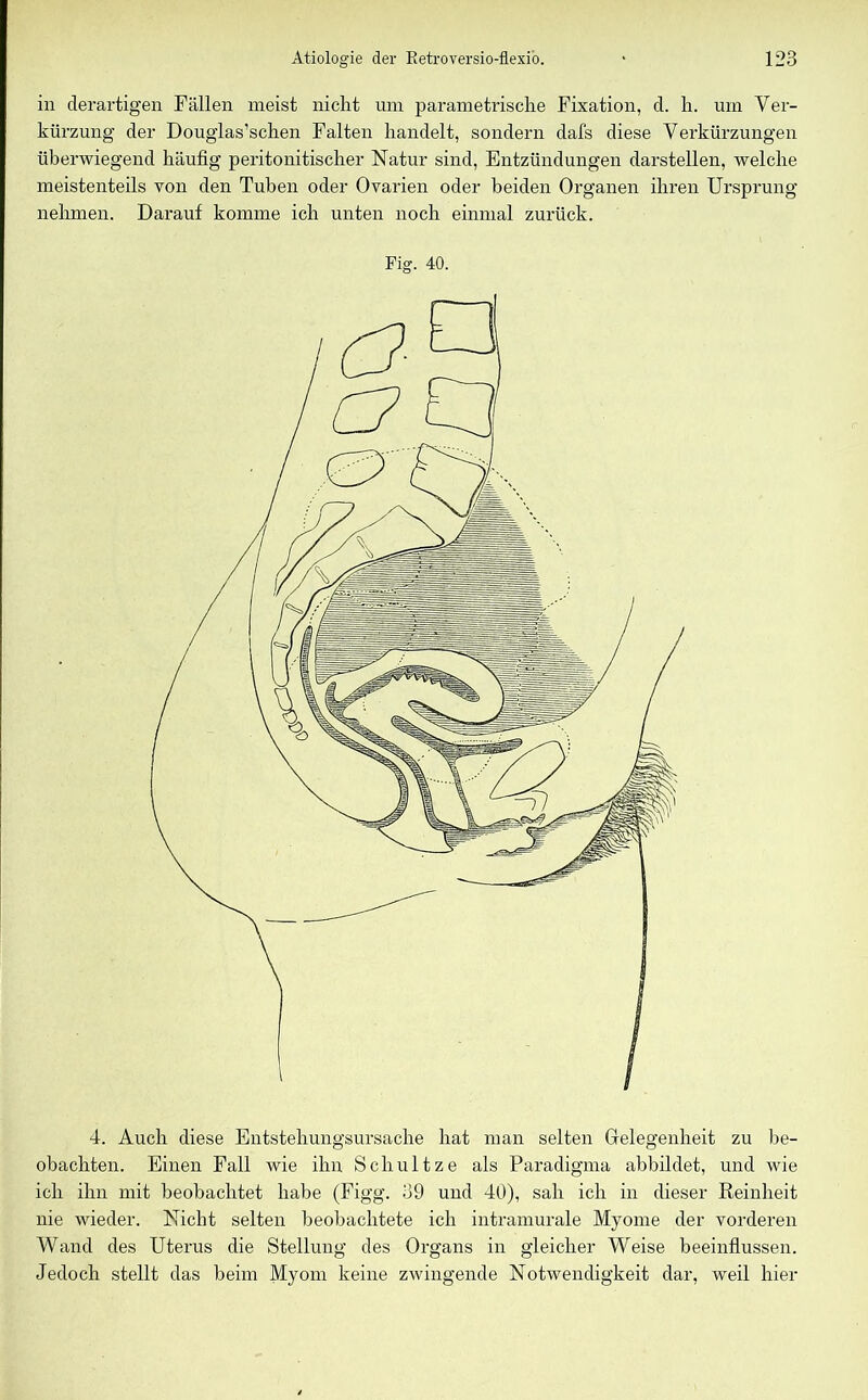 in derartigen Fällen meist nicht um parametrische Fixation, d. h. um Ver- kürzung der Douglas’schen Falten handelt, sondern dafs diese Verkürzungen überwiegend häufig peritonitischer Natur sind, Entzündungen darstellen, welche meistenteils von den Tuben oder Ovarien oder beiden Organen ihren Ursprung nehmen. Darauf komme ich unten noch einmal zurück. Fig. 40. 4. Auch diese Entstehungsursache hat man selten Gelegenheit zu be- obachten. Einen Fall wie ihn Schultze als Paradigma abbildet, und wie ich ihn mit beobachtet habe (Figg. 39 und 40), sah ich in dieser Reinheit nie wieder. Nicht selten beobachtete ich intramurale Myome der vorderen Wand des Uterus die Stellung des Organs in gleicher Weise beeinflussen. Jedoch stellt das beim Myom keine zwingende Notwendigkeit dar, weil hier