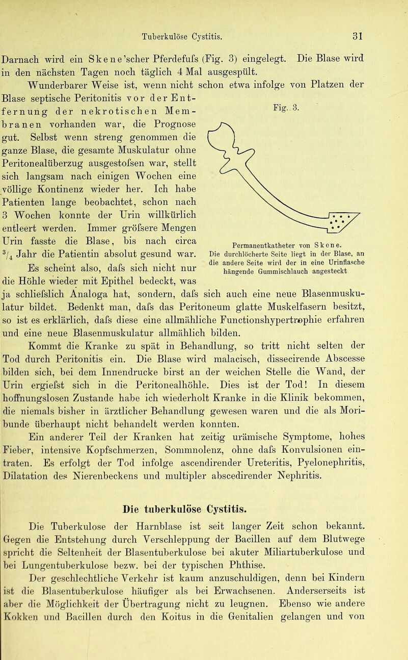 Darnach wird ein Skene’scher Pferdefufs (Fig. 3) eingelegt. Die Blase wird in den nächsten Tagen noch täglich 4 Mal ausgespült. Wunderbarer Weise ist, wenn nicht schon etwa infolge von Platzen der Blase septische Peritonitis vor der Ent- fernung der nekrotischen Mem- branen vorhanden war, die Prognose gut. Selbst wenn streng genommen die ganze Blase, die gesamte Muskulatur ohne Peritonealüberzug ausgestofsen war, stellt sich langsam nach einigen Wochen eine völlige Kontinenz wieder her. Ich habe Patienten lange beobachtet, schon nach 3 Wochen konnte der Urin willkürlich entleert werden. Immer gröfsere Mengen Urin fasste die Blase, bis nach circa 3/4 Jahr die Patientin absolut gesund war. Es scheint also, dafs sich nicht nur die Höhle wieder mit Epithel bedeckt, was ja schliefslich Analoga hat, sondern, dafs sich auch eine neue Blasenmusku- latur bildet. Bedenkt man, dafs das Peritoneum glatte Muskelfasern besitzt, so ist es erklärlich, dafs diese eine allmähliche Functionshypertrophie erfahren und eine neue Blasenmuskulatur allmählich bilden. Kommt die Kranke zu spät in Behandlung, so tritt nicht selten der Tod durch Peritonitis ein. Die Blase wird malacisch, dissecirende Abscesse bilden sich, bei dem Innendrucke birst an der weichen Stelle die Wand, der Urin ergiefst sich in die Peritonealhöhle. Dies ist der Tod! In diesem hoffnungslosen Zustande habe ich wiederholt Kranke in die Klinik bekommen, che niemals bisher in ärztlicher Behandlung gewesen waren und die als Mori- bunde überhaupt nicht behandelt werden konnten. Ein anderer Teil der Kranken hat zeitig urämische Symptome, hohes Fieber, intensive Kopfschmerzen, Sommnolenz, ohne dafs Konvulsionen ein- traten. Es erfolgt der Tod infolge ascendirender Ureteritis, Pyelonephritis, Dilatation des Nierenbeckens und multipler abscedirender Nephritis. Die tuberkulöse Cystitis. Die Tuberkulose der Harnblase ist seit langer Zeit schon bekannt. Gegen die Entstehung durch Verschleppung der Bacillen auf dem Blutwege spricht die Seltenheit der Blasentuberkulose bei akuter Miliartuberkulose und bei Lungentuberkulose bezw. bei der typischen Phthise. Der geschlechtliche Verkehr ist kaum anzuschuldigen, denn bei Kindern ist die Blasentuberkulose häufiger als bei Erwachsenen. Anderserseits ist aber die Möglichkeit der Übertragung nicht zu leugnen. Ebenso wie andere Kokken und Bacillen durch den Koitus in die Genitalien gelangen und von Fig.. 3. Permanentkatheter von Skone. Die durchlöcherte Seite liegt in der Blase, an die andere Seite wird der in eine Urinflasche hängende Gummiscblauch angesteckt