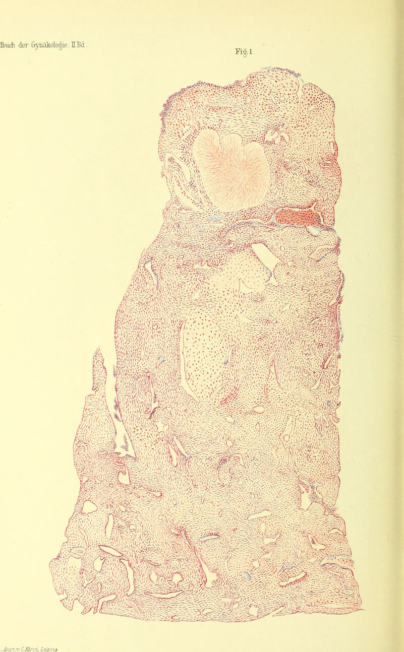 Ibuch der &ynakologis. IM ^i&l- 1: ii l»a %Ä! ; 'Vj ‘-'''//t w.? -- -> •’tiff ’ii//-- c/C'.;>>s's$wh WfilU ÄSii» iim; iSSÄ 'i;y'! /.*S ?v'o-\v; !S#«? ,' /ivri'« vv» * fÜ ,-AnsT,v. CEirst/, Läpziq