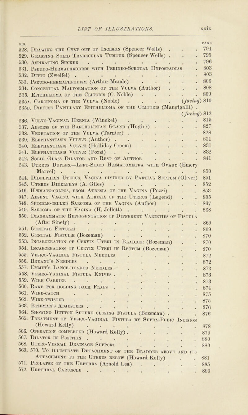FIG. PAGE 528. Drawing the Cyst out of Incision (Spencer Wells) . . . 794 529. Grasping Solid Trabecular Tumour (Spencer Wells) . . . 795 530. Aspirating Sucker . . . . . . . . .796 531. Pseudo-Hermaphrodism with Perineo-Scrotal Hypospadias . 803 532. Ditto (Zweifel) .......... 803 533. PsEUDO-HERMAPHRODiSM (Arthur Maude) ..... 806 534. Congenital Malformation of the Vulva (Author) . . . 808 535. Epithelioma of the Clitoris (C. Noble) ..... 809 535a. Carcinoma of the Vulva (Noble) .... {facing) 810 535b. Diffuse Papillary Epithelioma of the Clitoris (Mangigalli) . {facing) 812 536. Vulvo-Vaginal Hernia (Winckel) 537. Abscess of the Bartholinian Gland rHugicr) 538. Vegetation of the Vulva (Tarnier) . 539. Elephantiasis Aulv^ (Author) . 540. Elephantiasis Vulv^ (Halliday Croom) 541. Elephantiasis Vulv^e (Pozzi) 542. Solid Glass Dilator and Rest of Author 815 827 828 831 831 832 841 543. Uterus Duplex—Left-Sided H^ematometra with Ovary (Emery Marvel) ........... 544. Didelphian Uterus, Vagina divided by Partial Septum (Oliver) 545. Uterus Didelphys (A. Giles) ....... 546. H.®mato-colpos, from Atresia of the Vagina (Pozzi) 547. Absent Vagina with Atresia of the Uterus (Legend) 548. Spindle-celled Sarcoma of the Vagina (Author) 549. Sarcoma of the Vagina (H. Jellett) ...... 550. Diagrammatic Representation of Different Varieties of Fistula 850 851 852 853 855 867 868 (After Sinety) .......... 869 551. Genital Fistula ......... 869 552. Genital Fistula (Bozeman) ....... 870 553. Incarceration of Cervix Uteri in Bladder (Bozeman) . . 870 554. Incarceration of Cervix Uteri in Rectum (Bozeman) . . 870 555. Vesico-Vaginal Fistula Xeedles ...... 872 556. Bryant’s Needles ......... 872 557. Emmet’s Lance-headed Needles ...... 873 558. Vesico-Vaginal Fistula Knives 873 559. Wire Carrier .......... 873 560. Rake for holding back Flaps ....... 874 561. Wire-catch 875 562. Wire-twister .......... 875 563. Bozeman’s Adjusters ......... 876 564. Showing Button Suture cj.osing Fistula (Bozeman) . . . 876 56.5. Treatment of Vesico-Vaginal Fistula by Supra-Pubic Incision (Howard Kelly) 878 566. Operation completed (Howard Kelly) 879 567. Dilator in Position 880 568. Utero-Vesical Drainage Support ...... 880 569. 5/0. To ILLUSTRATE DETACHMENT OF THE BlADDER ABOVE AND ITS Attachment to the Uterus below (Howard Kelly) . .881 571. Prolapse of the Urethra (Arnold Lea) 885 572. Urethral Caruncle ......... 890