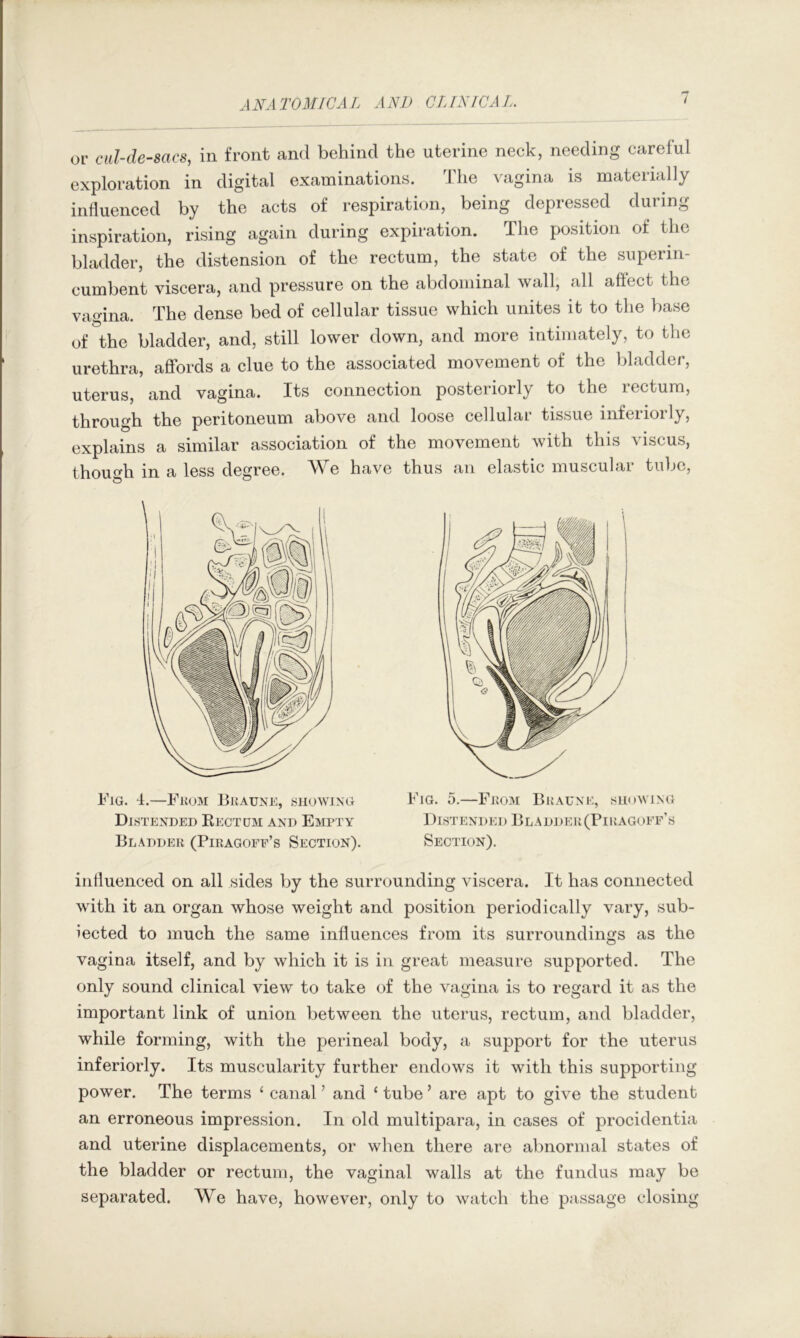 or cul-de-sacs, in front and behind the uterine neck, needing careful exploration in digital examinations. ^Idie vagina is materially influenced by the acts of respiration, being depressed during inspiration, rising again during expiration. The position of the bladder, the distension of the rectum, the state of the superin- cumbent viscera, and pressure on the abdominal wall, all afiect the vagina. The dense bed of cellular tissue which unites it to the base of the bladder, and, still lower down, and more intimately, to the urethra, affords a clue to the associated movement of the bladder, uterus, and vagina. Its connection posteriorly to the rectum, through the peritoneum above and loose cellular tissue inferiorly, explains a similar association of the movement with this viscus, thouo'h in a less degree. We have thus an elastic muscular tube. Fig. 4.—Fko3i Buauxe, showing Distended Kectum and Empty Bladder (Pieagoee’s Section). Fig. 5.—From Braune, showing Distended Bladder(Piragoff’s Section). influenced on all sides by the surrounding viscera. It has connected wdth it an organ whose weight and position periodically vary, sub- iected to much the same influences from its surroundings as the vagina itself, and by which it is in great measure supported. The only sound clinical view to take of the vagina is to regard it as the important link of union between the uterus, rectum, and bladder, while forming, with the perineal body, a support for the uterus inferiorly. Its muscularity further endows it with this supporting power. The terms ‘ canal’ and ‘tube’ are apt to give the student an erroneous impression. In old multipara, in cases of procidentia and uterine displacements, or when there are abnormal states of the bladder or rectum, the vaginal walls at the fundus may be separated. We have, however, only to watch the passage closing