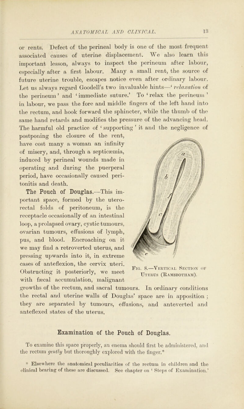 or rents. Defect of the perineal body is one of the most frequent associated causes of uterine displacement. e also learn this important lesson, always to inspect the perineum after labour, especially after a first labour. Many a small rent, the source of future uterine trouble, escapes notice even after ordinary labour. Let us always regard Goodell’s two invaluable hints—‘ ndaxation of the perineum’ and ‘immediate suture.’ To ‘relax the perineum’ in labour, we pass the fore and middle fingers of the left hand into the rectum, and hook forward the sphincter, while the thumb of the same hand retards and modifies the pressure of the advancing head. The harmful old practice of ‘ supporting ’ it and the negligence of postponing the closure of the rent, have cost many a woman an infinity of misery, and, through a septicaemia, induced by perineal wounds made in operating and during the puerperal period, have occasionally caused peri- tonitis and death. The Pouch of Douglas.—This im- portant space, formed by the utero- rectal folds of peritoneum, is the receptacle occasionally of an intestinal loop, a prolapsed ovary, cystic tumours, ovarian tumours, effusions of lymph, pus, and blood. Encroaching on it we may find a retroverted uterus, and pressing upwards into it, in extreme cases of anteflexion, the cervix uteri. Obstructing it posteriorly, we meet with faecal accumulation, malignant growths of the rectum, and sacral tumours. In ordinary conditions the rectal and uterine walls of Douglas’ space are in apposition ; they are separated by tumours, eftusions, and anteverted and anteflexed states of the uterus. Fig. 8,—Vertical Section of Uterus (Ramsbotiiam). Examination of the Pouch of Douglas. To examine this space properly, an enema slionld first be administered, and the rectum gently but thoroughly explored with the finger.* * Elsewhere the anatomical peculiarities of Ihe rectum in children and the clinical bearing of these are discussed. See chapter on ‘ Steps of Examination.’