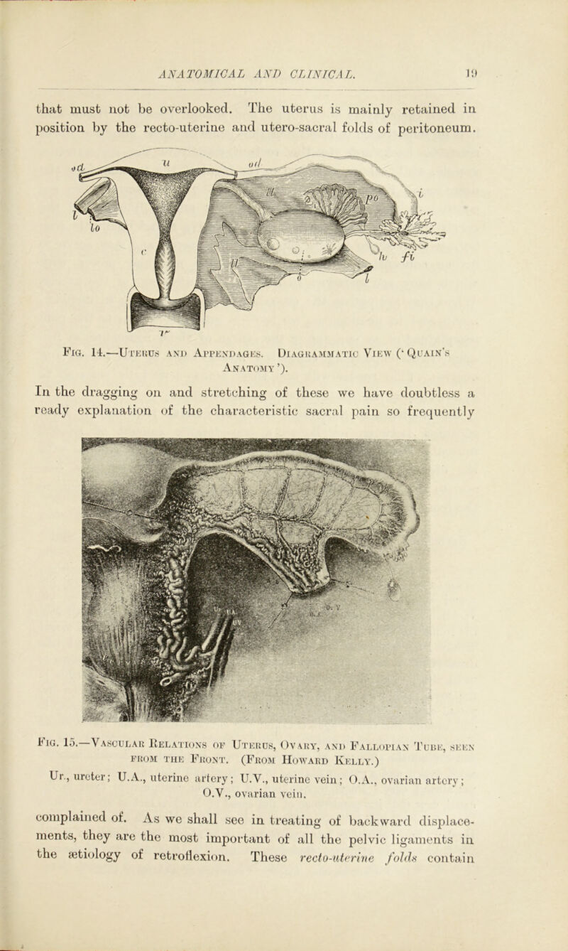 that must not be overlooked. The uterus is mainly retained in position by the recto-uterine and utero-sacral folds of peritoneum. In the dragging on and stretching of these we have doubtless a ready explanation of the characteristic sacral pain so frequently Fig. lo.—Vascular Kelatioxs of FitoM THE Front. Uterus, Ov ary, and Falloitax Turk, (From Howard Kelly.) SEKX Ur., ureter; U.A., uterine artery; U.V., uterine vein O.V., ovarian vein. O.A., ovarian artery; complained of. As we shall see in treating of backward displace- ments, they are the most important of all the pelvic ligaments in the aetiology of retroflexion. These recto-uterine folds contain