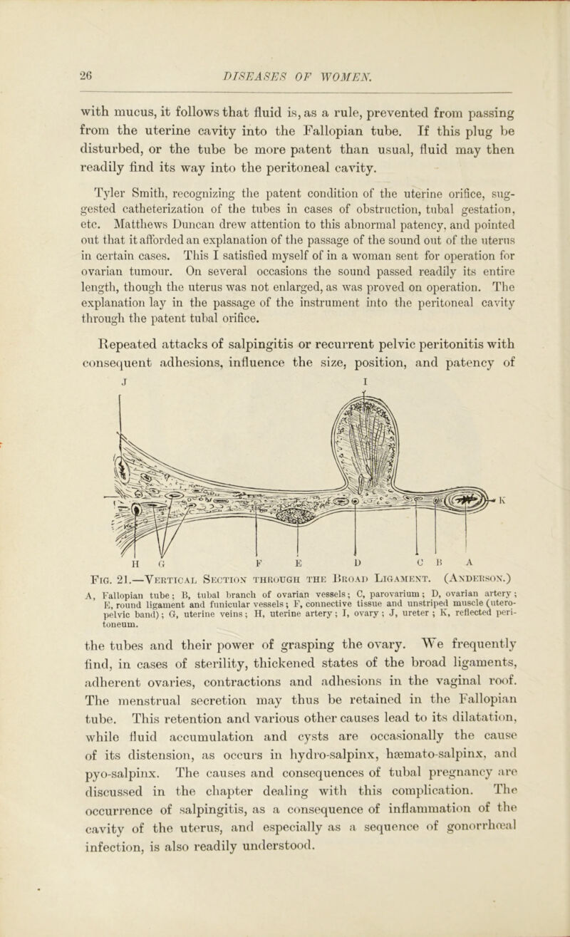 with mucus, it follows that fluid is, as a rule, prevented from passing from the uterine cavity into the Fallopian tube. If this plug be disturbed, or the tube be more patent than usual, fluid may then readily find its way into the peritoneal cavity. Tyler Smith, recognizing the patent condition of the uterine orifice, sug- gested catheterization of the tubes in cases of obstruction, tubal gestation, etc. Matthews Duncan drew attention to this abnormal patency, and pointed out that it afforded an explanation of the passage of the sound out of the uterus in certain cases. This I satisfied myself of in a woman sent for operation for ovarian tumour. On several occasions the sound passed readily its entire length, though the uterus was not enlarged, as was proved on operation. The explanation lay in the passage of the instrument into the peritoneal cavity through the patent tubal orifice. Repeated attacks of salpingitis or recurrent pelvic peritonitis with consequent adhesions, influence the size, position, and patency of j I Fig. 21.—Vertical Section through the Droad Ligament. (Anderson.) A, Fallopian tube; B, tubal branch of ovarian vessels; C, parovarium; D, ovarian artery; E, round ligament and funicular vessels; F, connective tissue and unstriped muscle (utero- pelvic band); G, uterine veins; H, uterine artery; I, ovary ; J, ureter ; K, reflected peri- toneum. the tubes and their power of grasping the ovary. We frequently find, in cases of sterility, thickened states of the broad ligaments, adherent ovaries, contractions and adhesions in the vaginal roof. The menstrual secretion may thus be retained in the Fallopian tube. This retention and various other causes lead to its dilatation, while tluid accumulation and cysts are occasionally the cause of its distension, as occurs in hydro-salpinx, hfemato-salpinx, and pyo-salpinx. The causes and consequences of tubal pregnancy are discussed in the chapter dealing with this complication. The occurrence of salpingitis, as a consequence of inflammation of the cavity of the uterus, and especially as a sequence of gonorrhmal infection, is also readily understood.