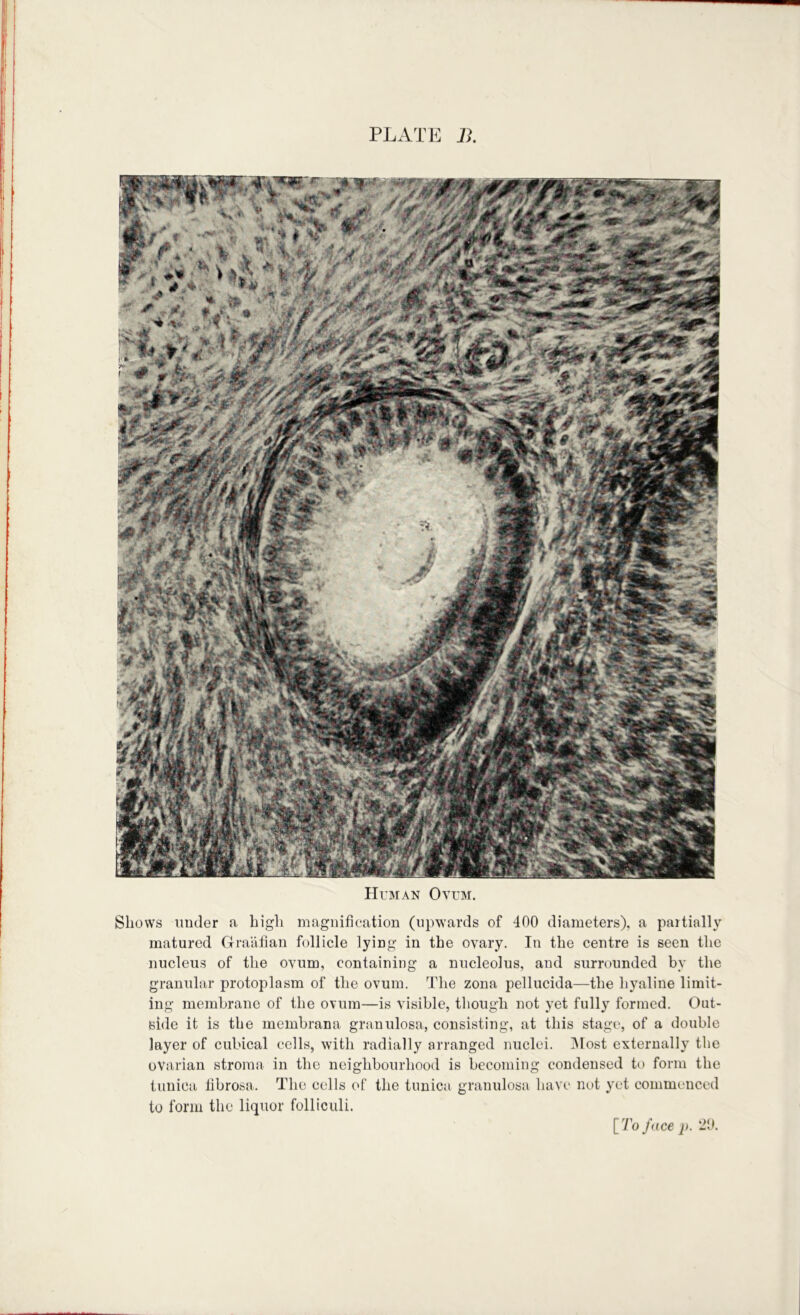 HrBiAN Ovoi. Shows muler a high magiiifioation (upwards of 400 diameters), a partially matured Graiilian follicle lying in the ovary. Iii the centre is seen the nucleus of the ovum, containing a nucleolus, and surrounded by the granular protoplasm of the ovum. The zona pellucida—the hyaline limit- ing membrane of the ovum—is visible, though not yet fully formed. Out- side it is the membrana granulosa, consisting, at this stage, of a double layer of cubical cells, with radially arranged nuclei. ]\Iost externally the ovarian stroma in the neighbourhood is becoming condensed to form the tunica tibrosa. The cells of the tunica granulosa have nut yet commenced to form the liquor folliculi. [7b f<(ce p. 21>.