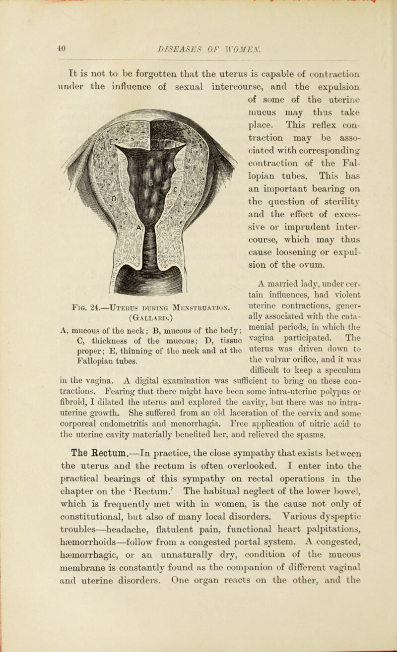 It is not to be forgotten that the uterus is capable of contraction under the influence of sexual intercourse, and the expulsion of some of the uterine mucus may thus take place. This reflex con- traction may be asso- ciated with corresponding contraction of the Fal- lopian tubes. This has an important bearing on the question of sterility and the effect of exces- sive or imprudent inter- course, which may thus cause loosening or exjiul- sion of the ovum. A married lady, under cer- tain influences, had violent uterine contractions, gener- ally associated with the cata- menial periods, in which the vagina participated. The proper; E, thinning of the neck and at the uterus was driven down to Fallopian tubes. the vulvar orifice, and it was difficult to keep a speculum in the vagina. A digital examination was sufficient to bring on these con- tractions. Fearing that there might have been some intra-uterine polypus or fibroid, I dilated the uterus and explored the cavity, but there was no intra- uterine growth. She suffered from an old laceration of the cervix and some corporeal endometritis and menorrhagia. Free application of nitric acid to the uterine cavity materially benefited her, and relieved the spasms. Fig. 24.—Uterus during Menstruation. (G ALLARD.) A, mucous of the neck; B, mucous of the body; C, tliickness of the mucous; D, tissue The Rectum.—In practice, the close sympathy that exists between the uterus and the rectum is often overlooked. I enter into the practical bearings of this sympathy on rectal operations in the chapter on the ‘ Rectum.’ The habitual neglect of the lower bowel, which is frequently met with in women, is the cause not only of constitutional, but also of many local disorders. Various dyspeptic troubles—headache, flatulent pain, functional heart palpitations, haemorrhoids—follow from a congested portal system. A congested, htemorrhagic, or an unnaturally dry, condition of the mucous membrane is constantly found as the companion of different vaginal and uterine disorders. One organ reacts on the other, and the