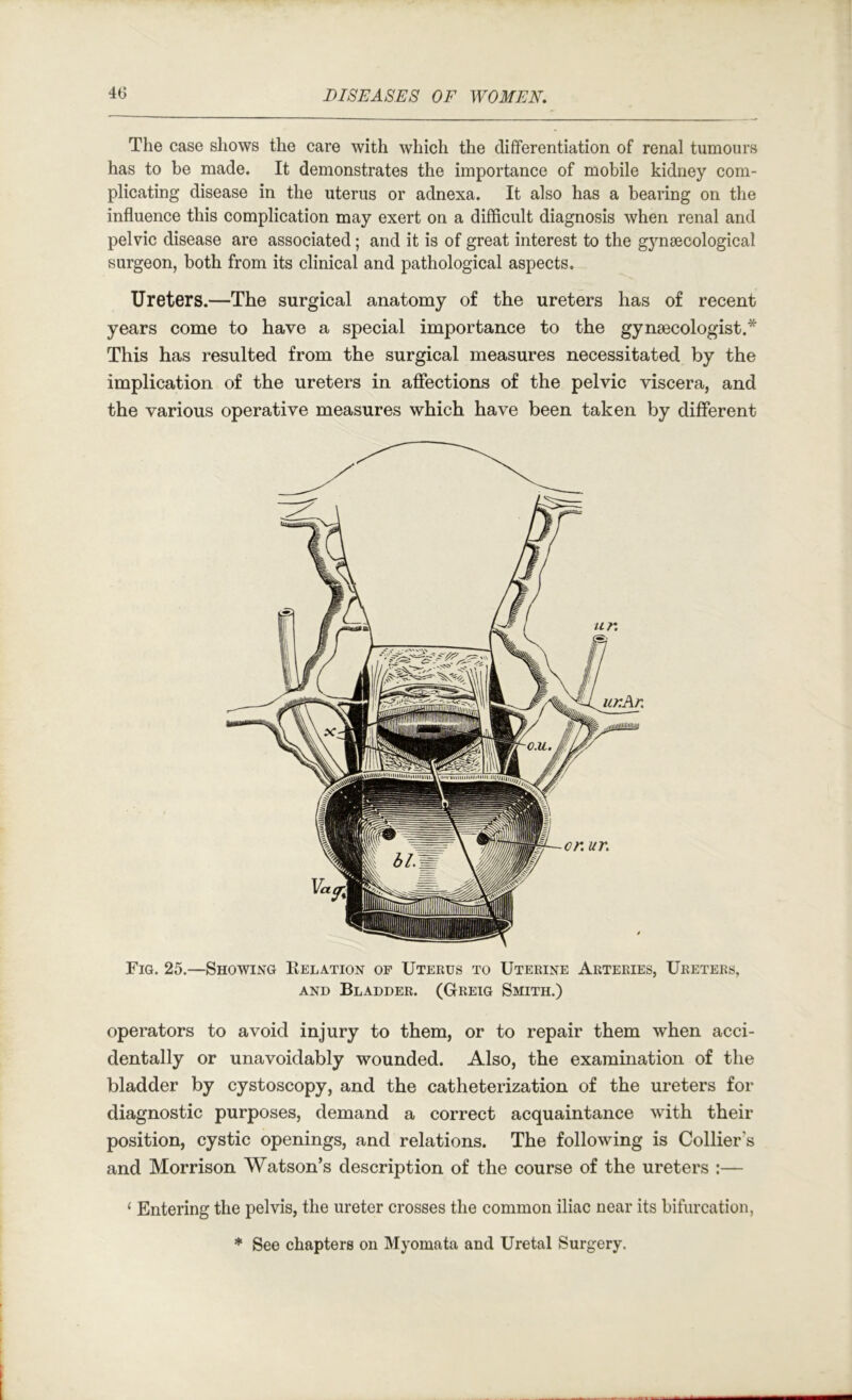 The case shows the care with which the differentiation of renal tumours has to be made. It demonstrates the importance of mobile kidney com- plicating disease in the uterus or adnexa. It also has a bearing on the influence this complication may exert on a difficult diagnosis when renal and pelvic disease are associated; and it is of great interest to the g5m8ecological surgeon, both from its clinical and pathological aspects. Ureters.—The surgical anatomy of the ureters has of recent years come to have a special importance to the gynaecologist.* This has resulted from the surgical measures necessitated by the implication of the ureters in affections of the pelvic viscera, and the various operative measures which have been taken by different Fig. 25.—Showing Eelation op Uterus to Uterine Arteries, Ureters, AND Bladder. (Greig Smith.) operators to avoid injury to them, or to repair them when acci- dentally or unavoidably wounded. Also, the examination of the bladder by cystoscopy, and the catheterization of the ureters for diagnostic purposes, demand a correct acquaintance with their position, cystic openings, and relations. The following is Collier’s and Morrison Watson’s description of the course of the ureters :— ‘ Entering the pelvis, the ureter crosses the common iliac near its bifurcation, * See chapters on Myomata and Uretal Surgery.