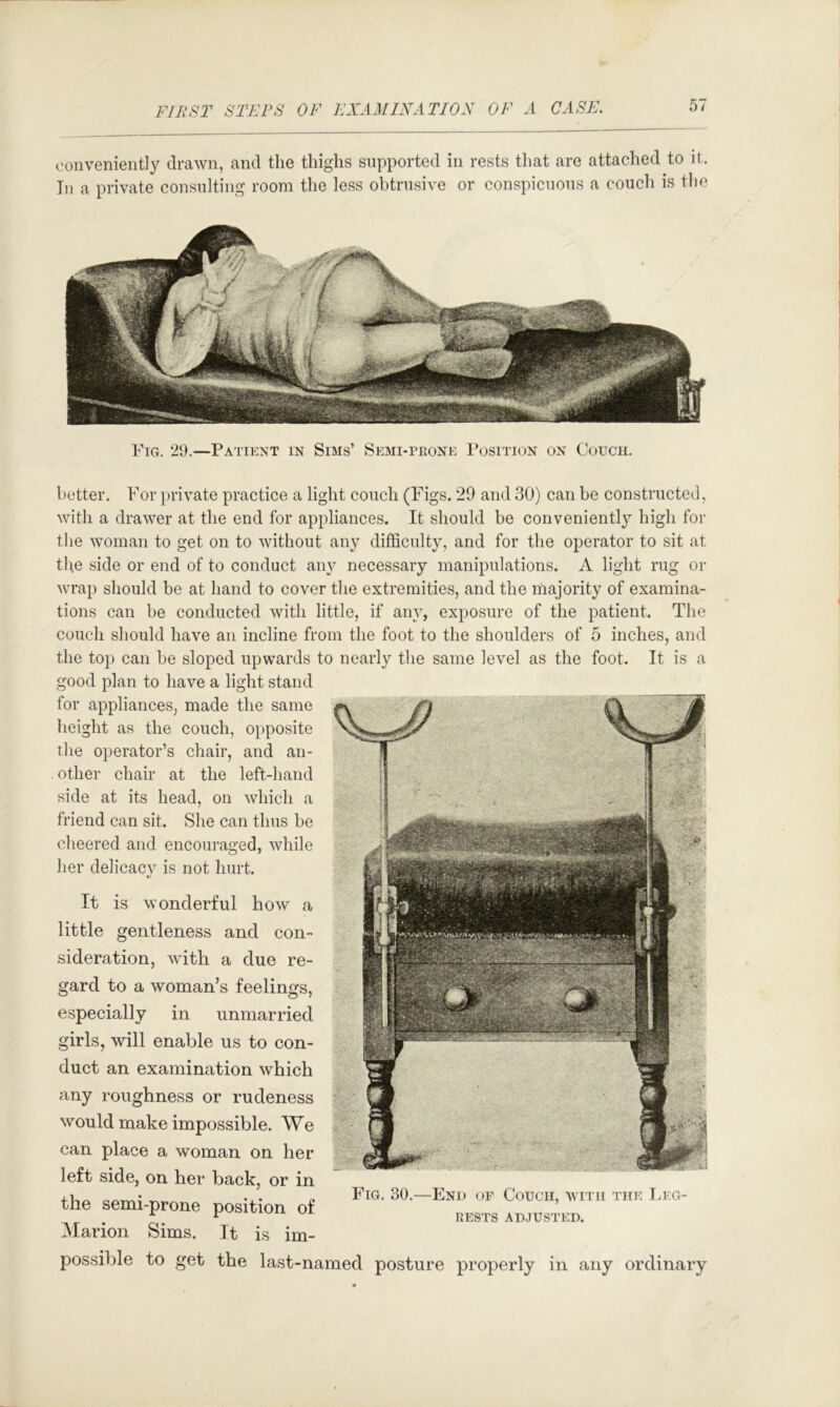oonveniently drawn, and the thighs supported in rests that are attached to it. In a private consulting room the less obtrusive or conspicnons a couch is the Fig. 29.—Patient in Sims’ Semi-prone Position on Couch. better. For ])rivate practice a light conch (Figs. 29 and 30) can be constructed, with a drawer at the end for appliances. It should be conveniently high for the woman to get on to without any difficulty, and for the operator to sit at the side or end of to conduct any necessary manipulations. A light rug or wrap should be at hand to cover the extremities, and the majority of examina- tions can be conducted with little, if any, exposure of the patient. The couch should have an incline from the foot to the shoulders of 5 inches, and the top can be sloped upwards to nearly the same level as the foot. It is a good plan to have a light stand for appliances, made the same height as the couch, opposite the operator’s chair, and an- other chair at the left-hand side at its head, on which a friend can sit. She can thus be clieered and encouraged, while her delicacv is not hurt. t/ It is wonderful how a little gentleness and con- sideration, with a due re- gard to a woman’s feelings, especially in unmarried girls, will enable us to con- duct an examination which any roughness or rudeness would make impossible. We can place a woman on her left side, on her back, or in +1-.^ erv-rv.; ^ -X- .. Fig. 30.—End of Couch, with the I.eg- the semi-prone position ot Marion Sims. It is im- possible to get the last-named posture properly in any ordinary