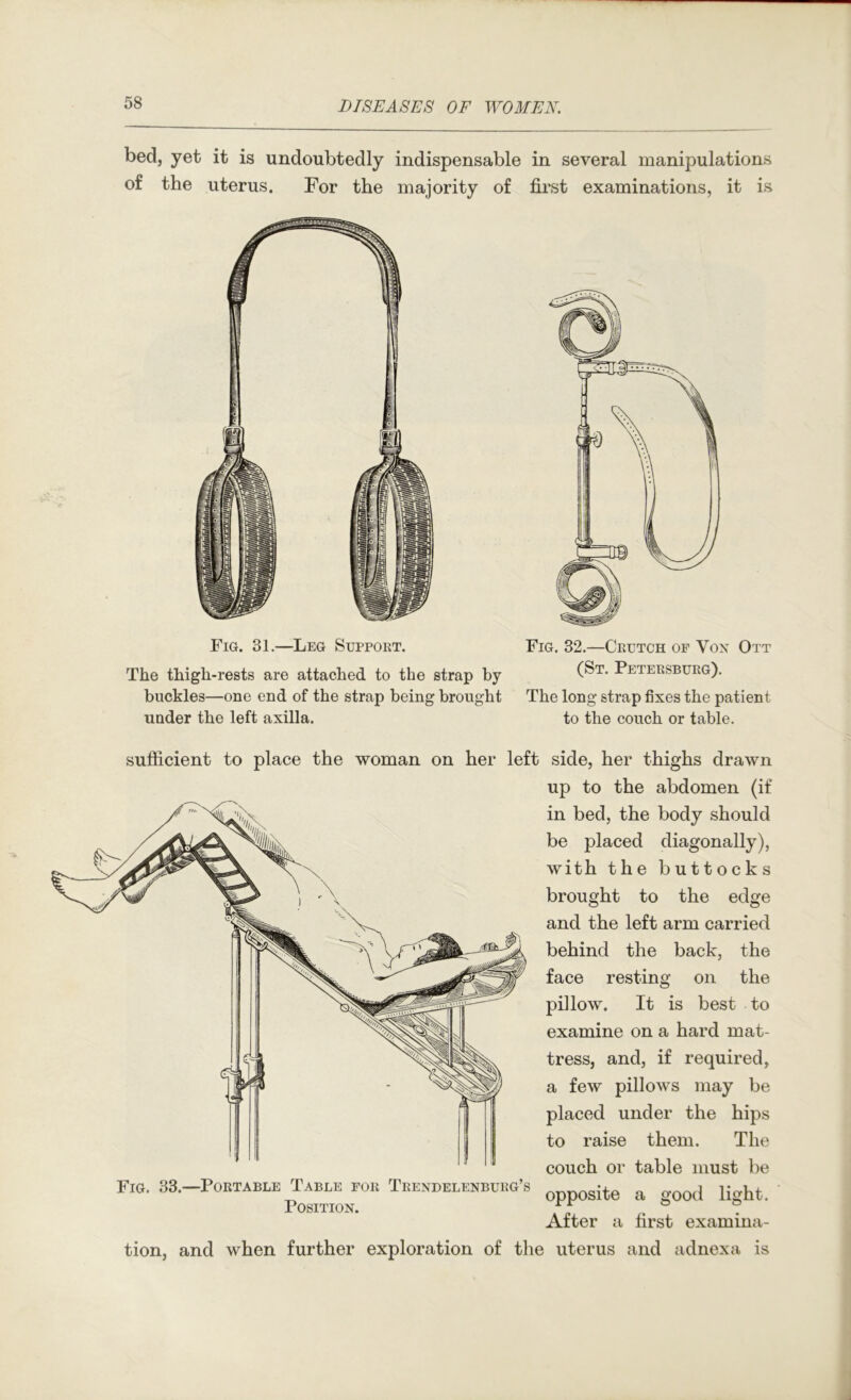 bed, yet it is undoubtedly indispensable in several manipulations of the uterus. For the majority of first examinations, it is Fig. 31.—Leg Suppoet. The thigh-rests are attached to the strap by buckles—one end of the strap being brought under the left axilla. Fig. 32.—Crutch of Vox Ott (St. Petersburg). The long strap fixes the patient to the couch or table. sufficient to place the woman on her left side, her thighs drawn up to the abdomen (if in bed, the body should be placed diagonally), with the buttocks brought to the edge and the left arm carried behind the back, the face resting on the pillow. It is best to examine on a hard mat- tress, and, if required, a few pillows may be placed under the hips to raise them. The couch or table must be opposite a good light. After a first examina- tion, and when further exploration of the uterus and adnexa is Fig. 33.—Portable Table for Trendelenburg’s Position.