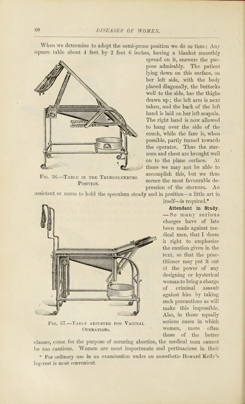 Fig. 66.—Table in the Trendi:lenburg Position. Wlieu we determine to adopt the semi-prone position we do so thus: Any square table about 4 feet by 2 feet G inches, having a blanket smoothly spread on it, answers the pur- pose admirably. The patient lying down on this suiface, on her left side, with the body placed diagonally, the buttocks well to the side, has the thighs drawn up; the left arm is next taken, and the back of the left hand is laid on her left scapula. The right hand is now allowed to hang over the side of the couch, while the face is, when possible, partly turned towards the operator. Thus the ster- num and chest are brought well on to the plane surface. At times we may not be able to accomplish this, but we thus secure the most favourable de- pression of the sternum. An assistant or nurse to hold the speculum steady and in position—a little art in itself—is required.* Attendant in Study. — So manv serious «/ charges have of late been made against me- dical men, that I deem it right to emphasize the caution given in the text, so that the prac- titioner may put it out ct the power of any designing or hysterical woman to bring a charge of criminal assault against him by taking such precautions as will make this impossible. Also, in those equally serious cases in which often women more Fig. 37.—Table adjusted for Vaginal Operations. those of the better classes, come for the purpose of securing abortion, the medical man cannot be too cautious. Women are most importunate and pertinacious in their * For ordinary use in an examination under an anesthetic Howard Kelly’s leg-rest is most convenient.