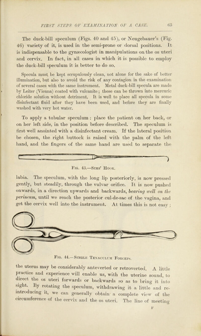 The duck-bill speculum (Figs. 40 and 45), or Neugebauer’s (Fig- 46) variety of it, is used in the semi-prone or dorsal positions. It is indispensable to the gynecologist in manipulations on the os uteri and cervix. In fact, in all cases in which it is possible to employ the duck-bill speculum it is better to do so. Specula must be kept scrupulously clean, not alone for the sake of better illumination, but also to avoid the risk of any contagion in the examination of several cases with the same instrument. Metal duck-bill specula are made by Leiter (Vienna) coated with vulcanite; these can be thrown into mercuric chloride solution without detriment. It is well to place all specula in some disinfectant fluid after they have been used, and before they are finally washed with very hot water. To apply a tubular speculum : place the patient on her back, or on her left side, in the position before described. The speculum is first well anointed with a disinfectant cream. If the lateral position be chosen, the right buttock is raised with the palm of the left hand, and the fingers of the same hand are used to separate the ) labia. The speculum, with the long lip posteriorly, is now pressed gently, but steadily, through the vulvar orifice. It is now pushed onwards, in a direction upwards and backwards, hearing well on the perineum, until we reach the posterior cul-de-sac of the vagina, and get the cervix well into the instrument. At times this is not easy; the uterus may be considerably anteverted or retroverted. A little practice and experience will enable us, with the uterine sound, to direct the os uteri forwards or backwards so as to bring it into sight. By rotating the speculum, withdrawing it a little and re- intioducing it, we can generally obtain' a complete view of the circumference of the cervix and the os uteri. The line of meetino- Fig. 43.—Sims’ Hook.