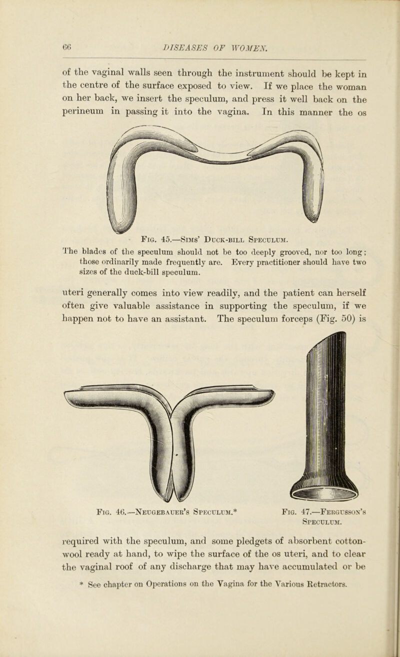 of the vaginal walls seen through the instrument should be kept in the centre of the surface exposed to view. If we place the woman on her back, we insert the speculum, and press it well back on the perineum in passing it into the vagina. In this manner the os 'J'he blades of the speculum should not be too deeply grooved, nor too long ; those ordinarily made frequently are. Every practitioner should have two sizes of the duck-bill speculum. uteri generally comes into view readily, and the patient can herself often give valuable assistance in supporting the speculum, if we happen not to have an assistant. The speculum forceps (Fig. 50) is Fig. 46.—Neugebatjer’s Speculum.* Fig. 47.—Fergusson’s Speculum. required with the speculum, and some pledgets of absorbent cotton- wool ready at hand, to wipe the surface of the os uteri, and to clear the vaginal roof of any discharge that may have accumulated or be * See chapter on Operations on the Vagina for the Various Retractors.